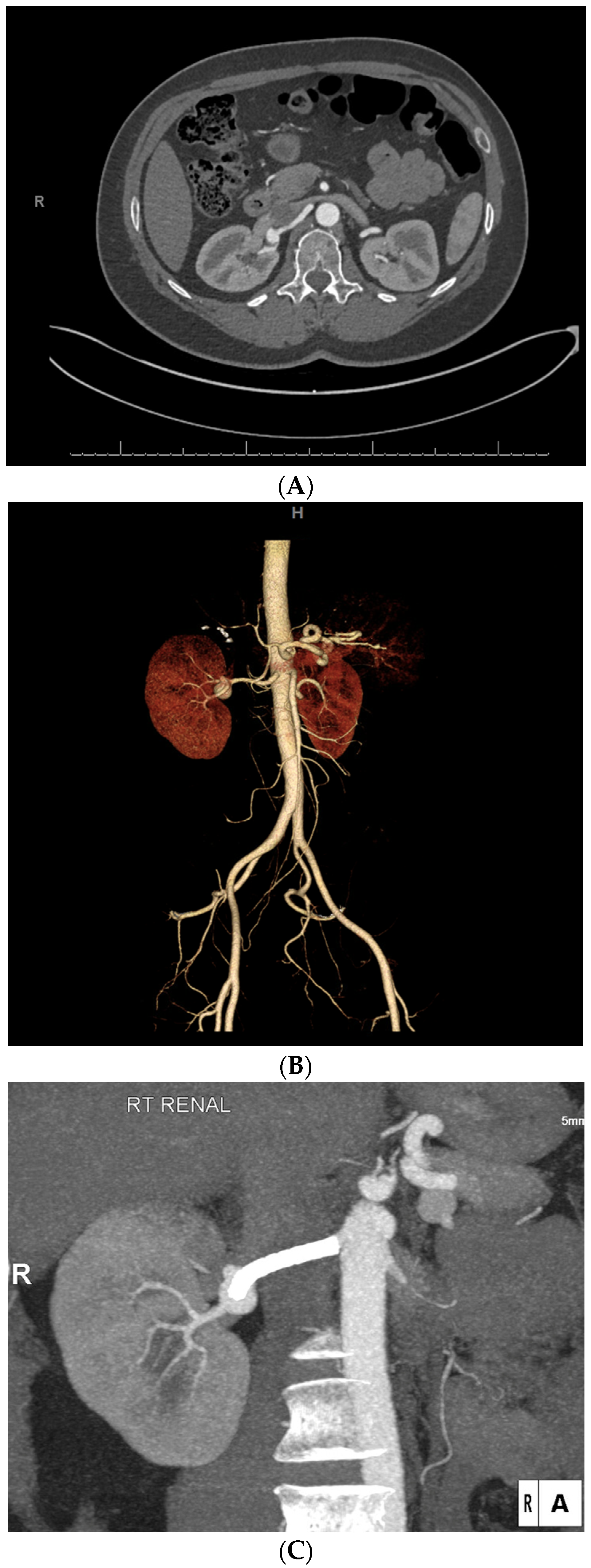 Diagnostics 14 01695 g007
