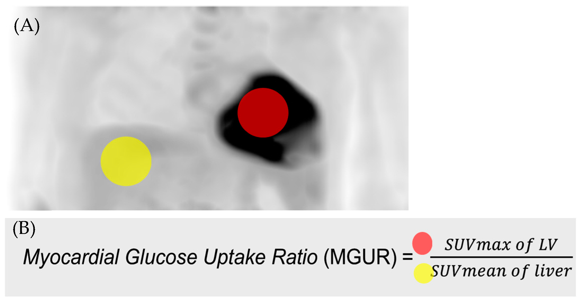 Diagnostics 14 01705 g002 Diagnostics 14 01705 g002