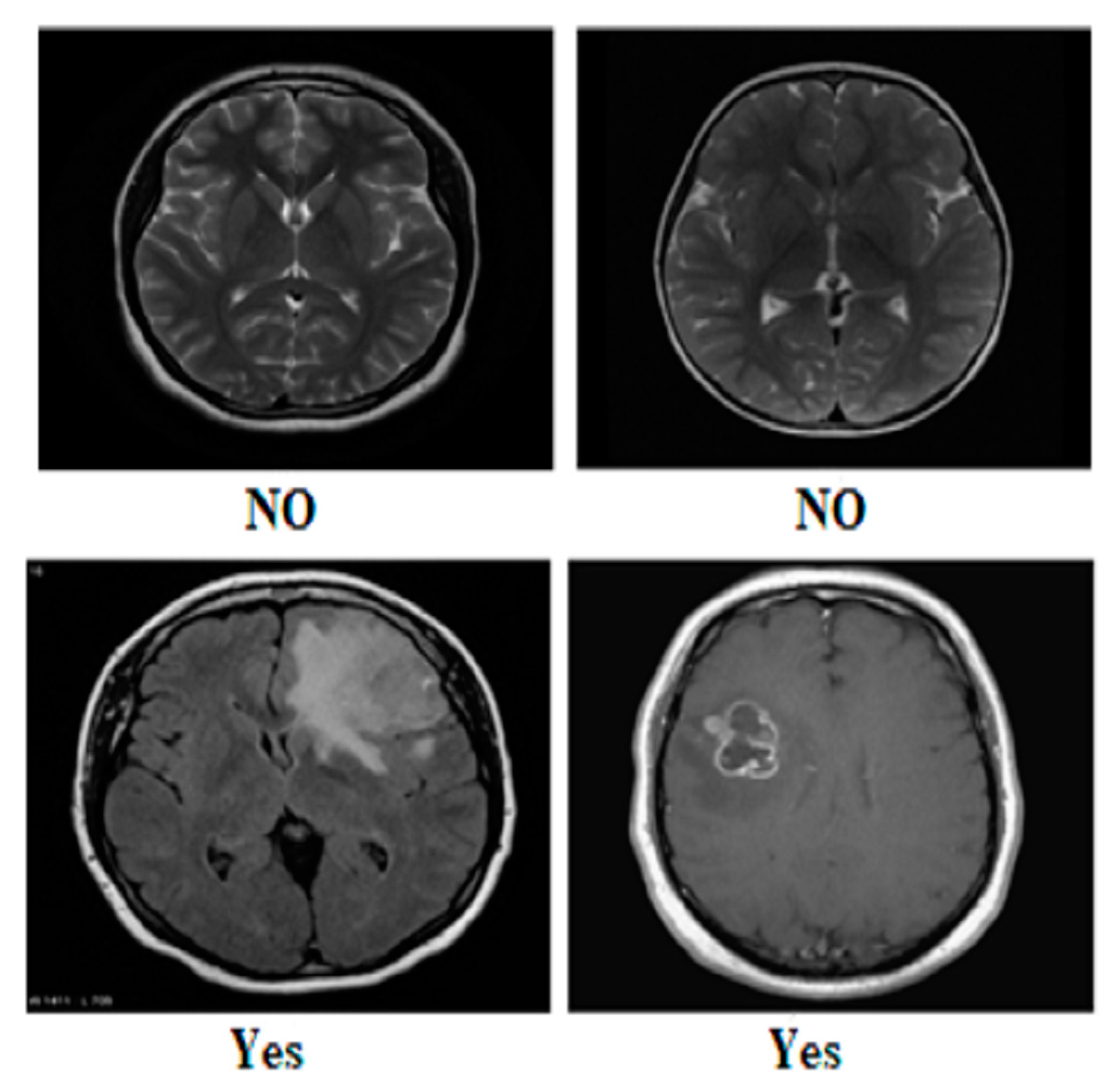 Diagnostics 14 01714 g001