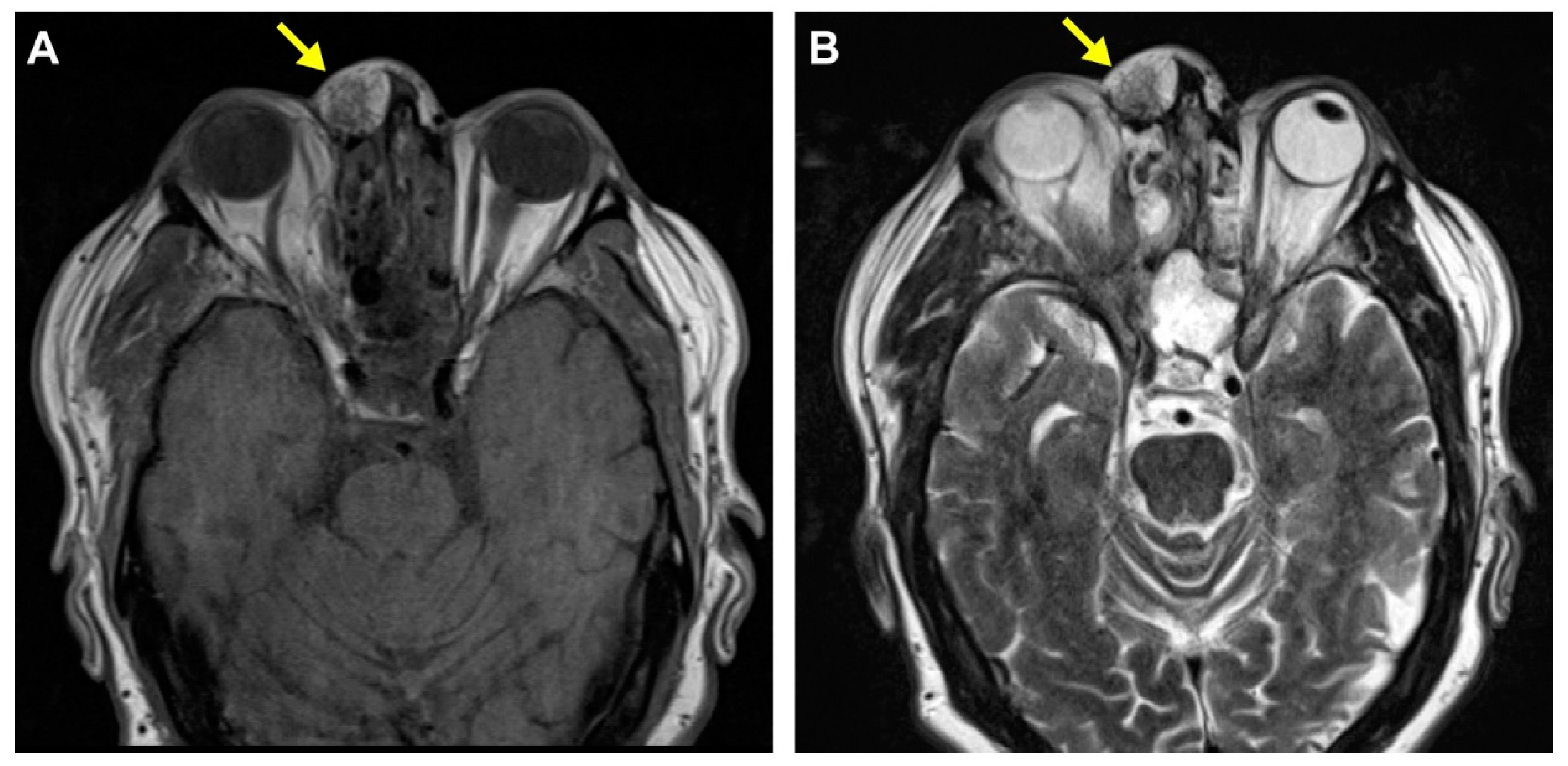 Diagnostics 14 01731 g001