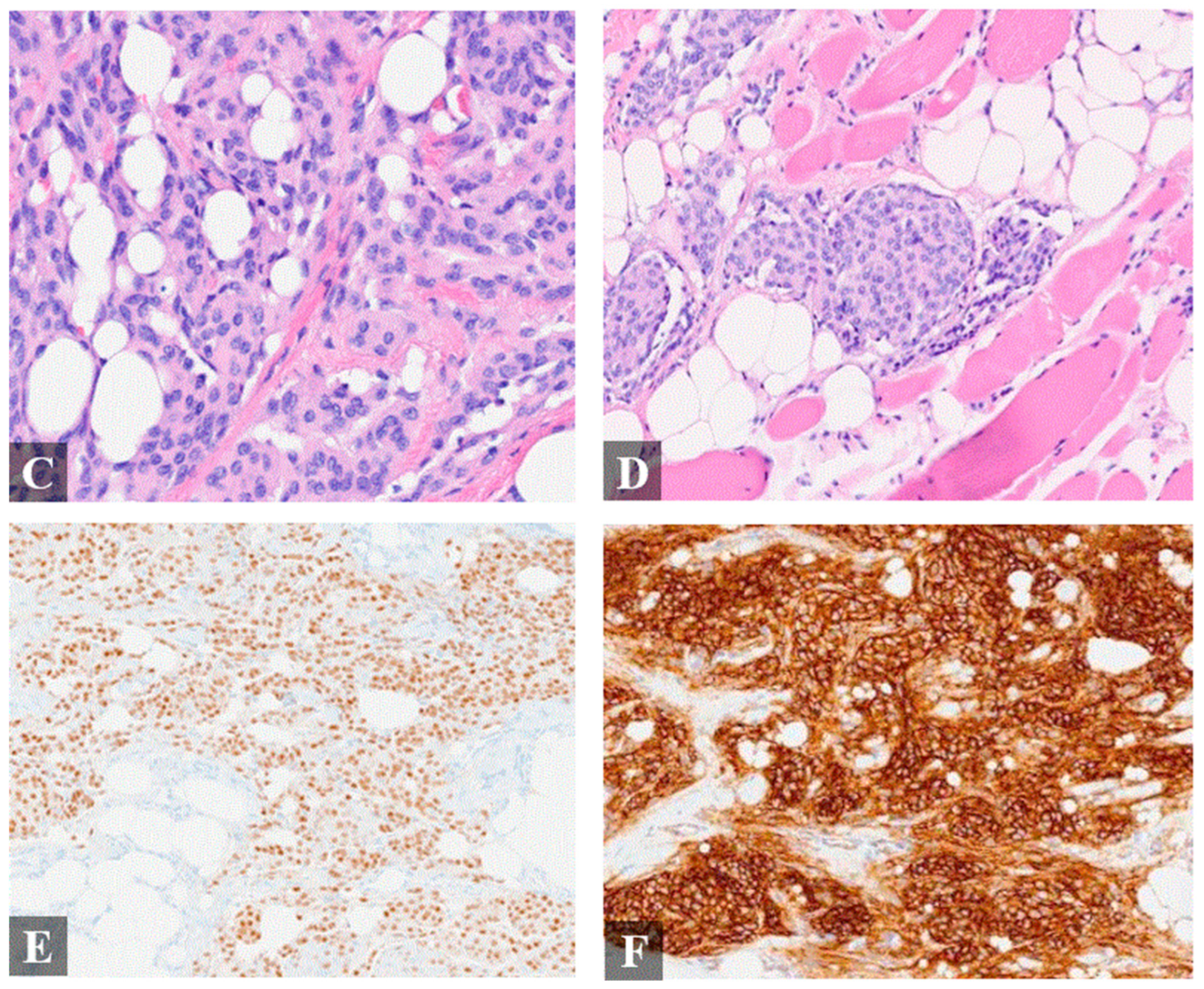 Diagnostics 14 01731 g002b