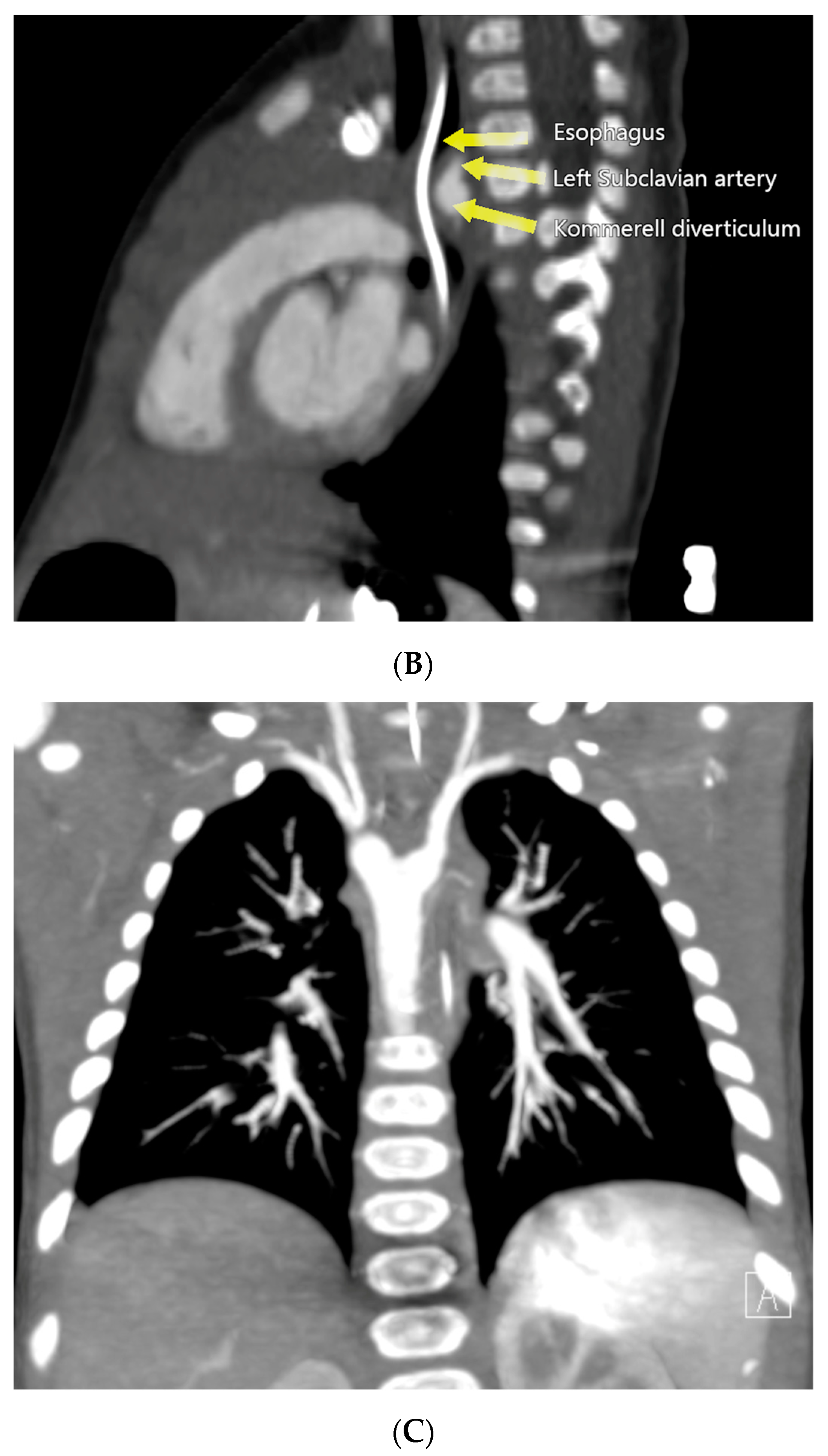 Diagnostics 14 01736 g002b