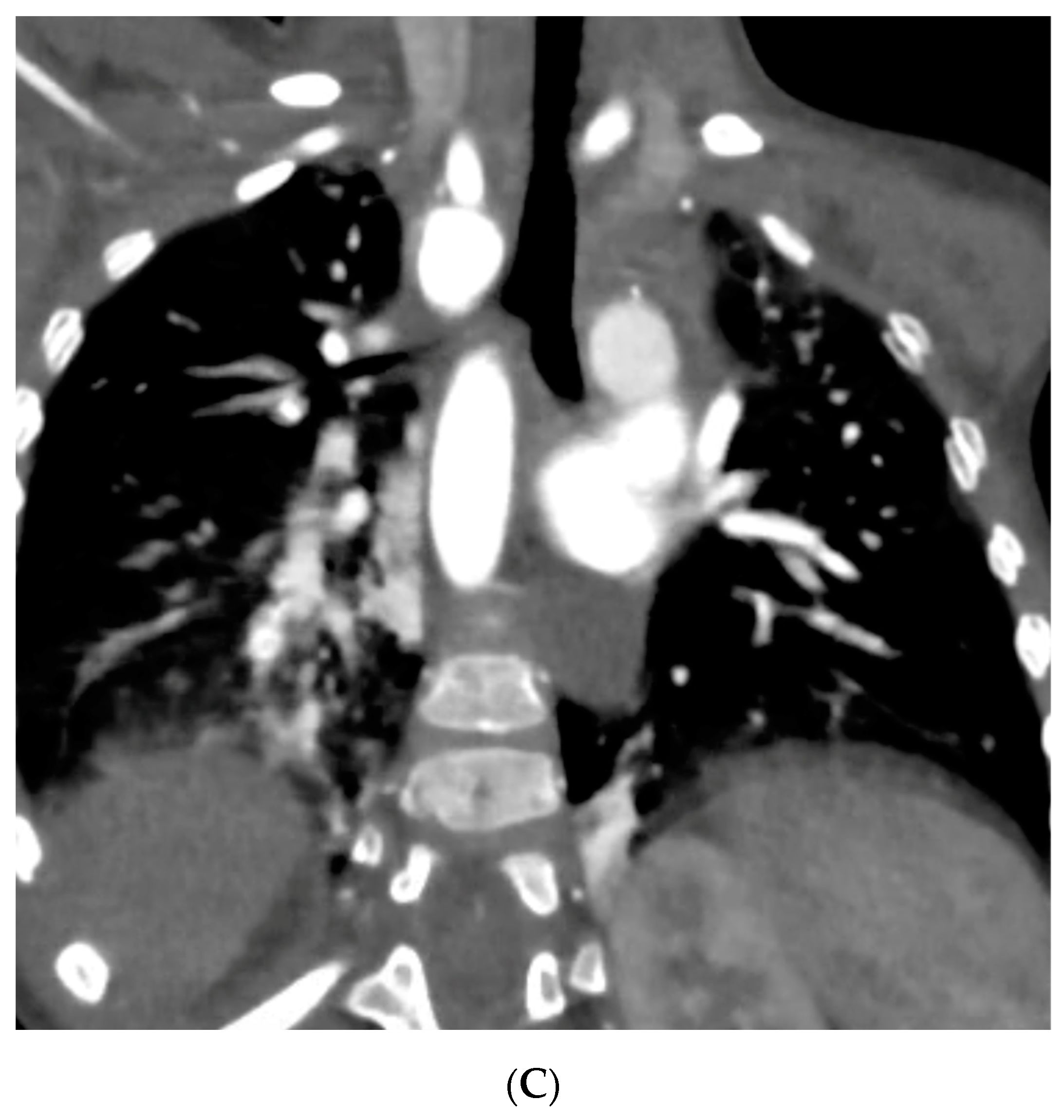 Diagnostics 14 01736 g003b