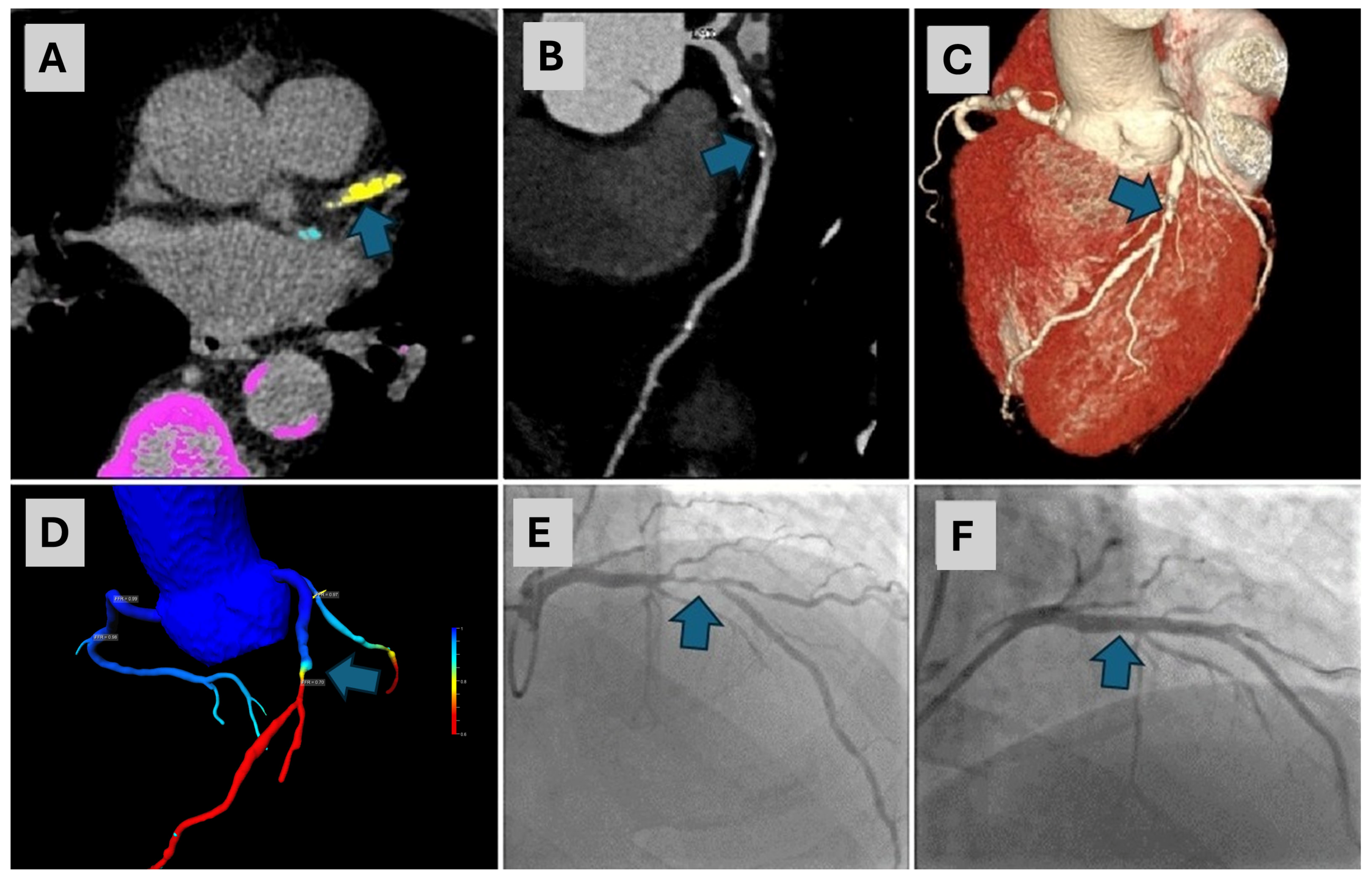 Diagnostics 14 01738 g003