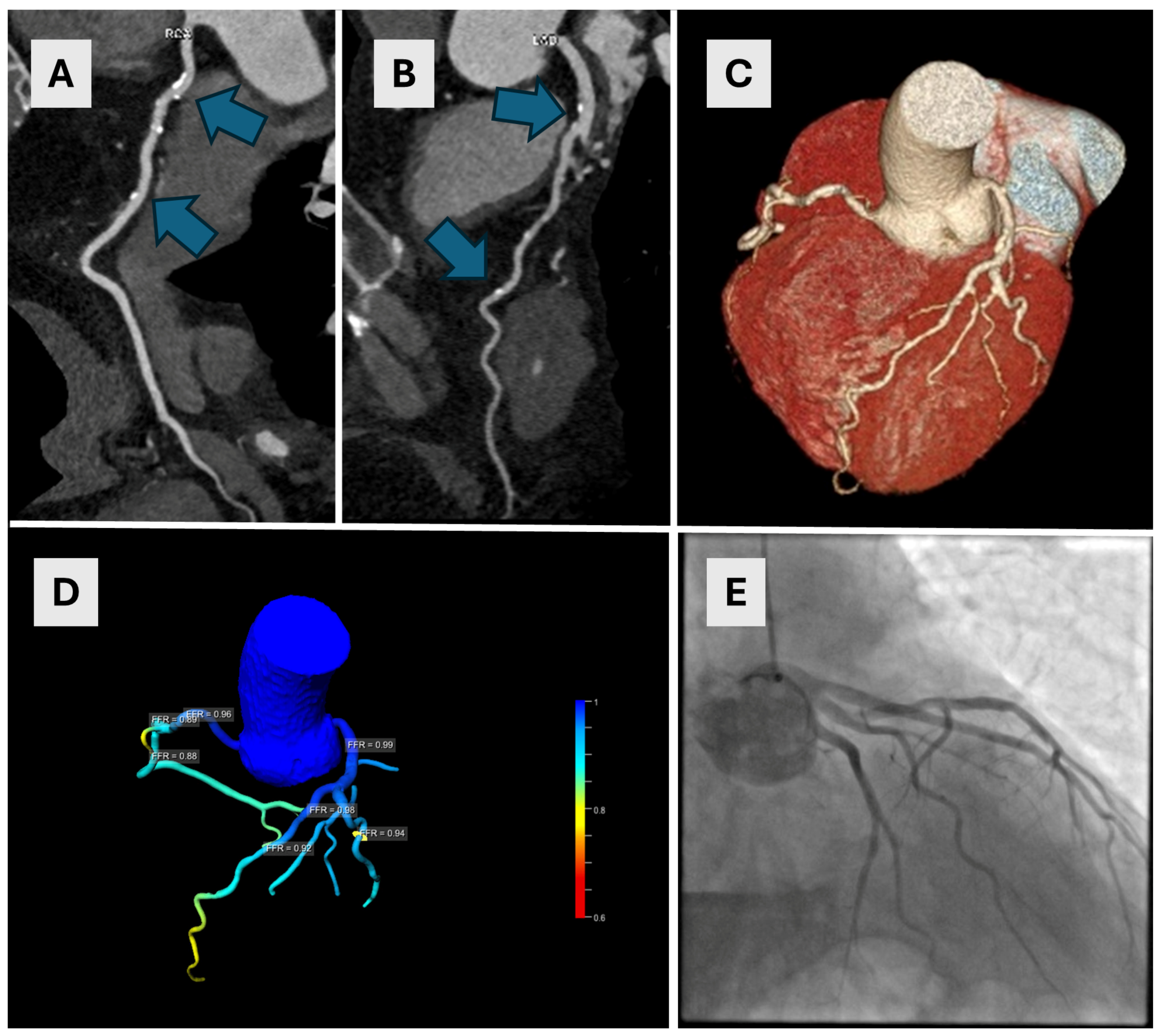 Diagnostics 14 01738 g005