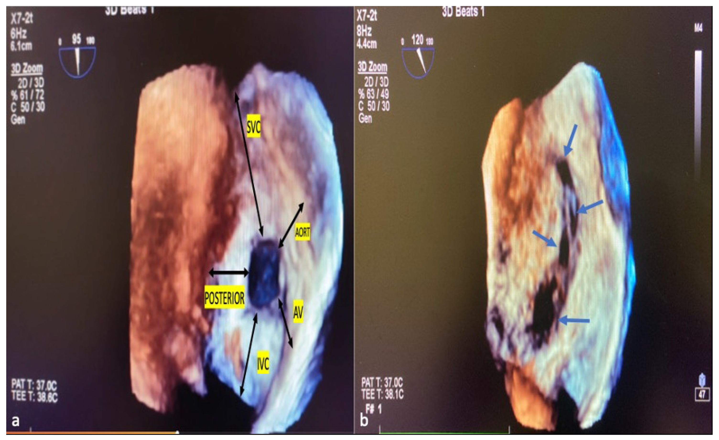 Diagnostics 14 01755 g004