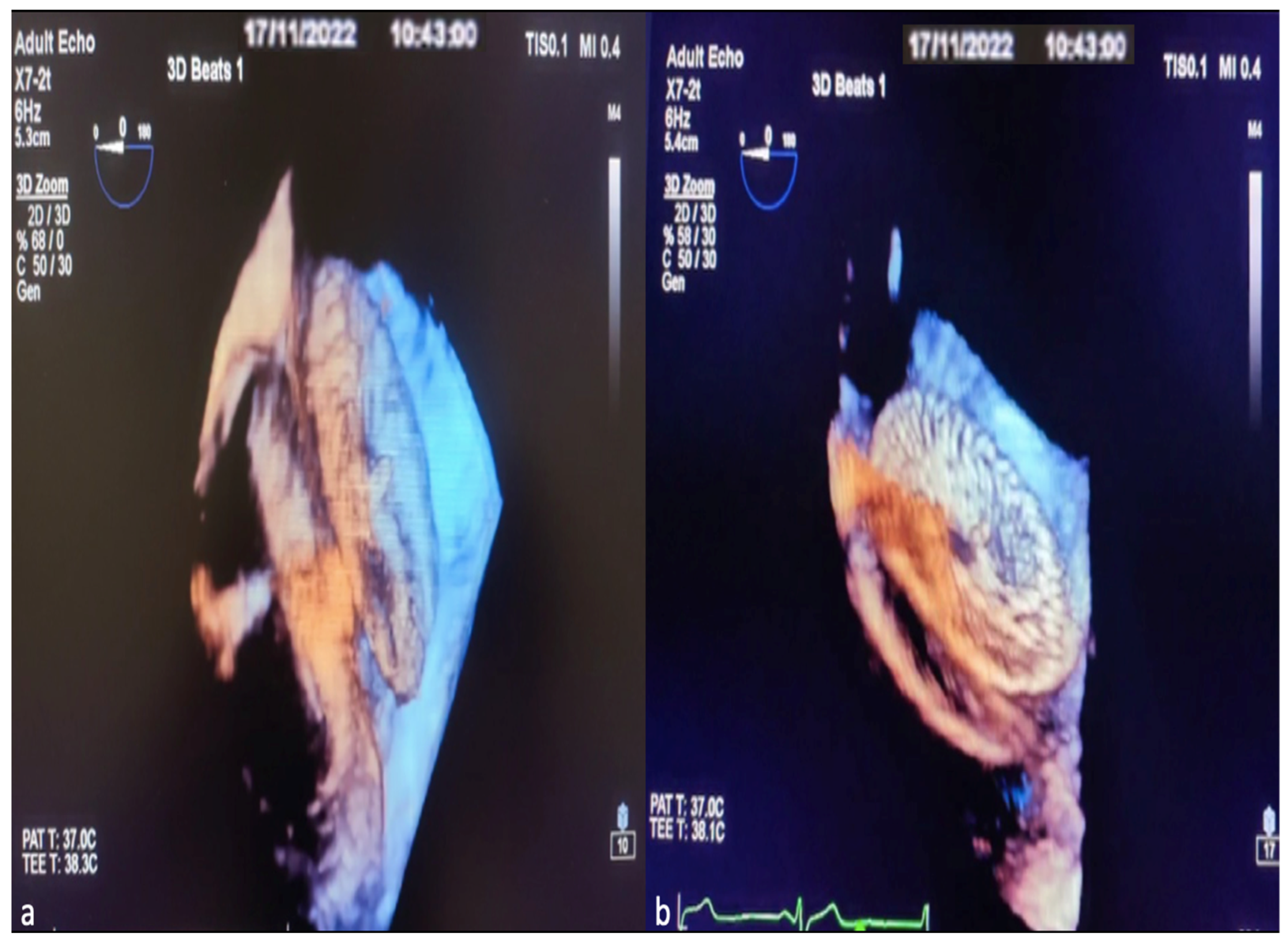 Diagnostics 14 01755 g005