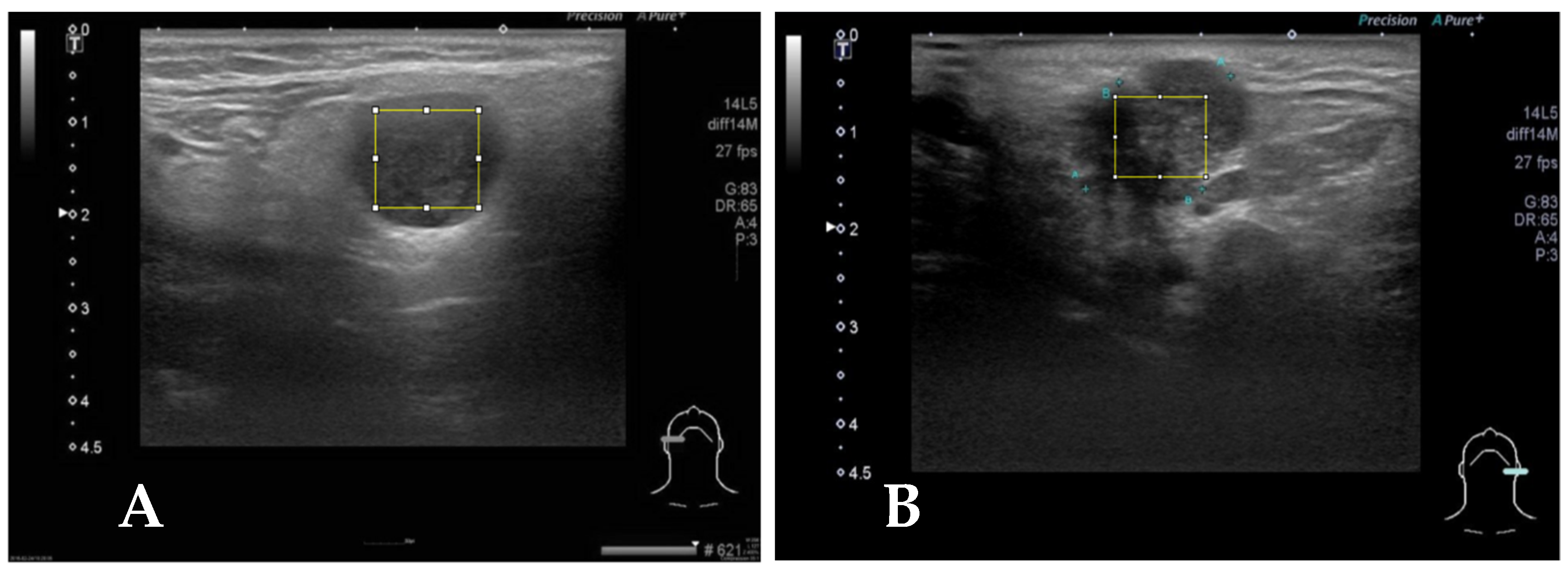 Diagnostics 14 01761 g002