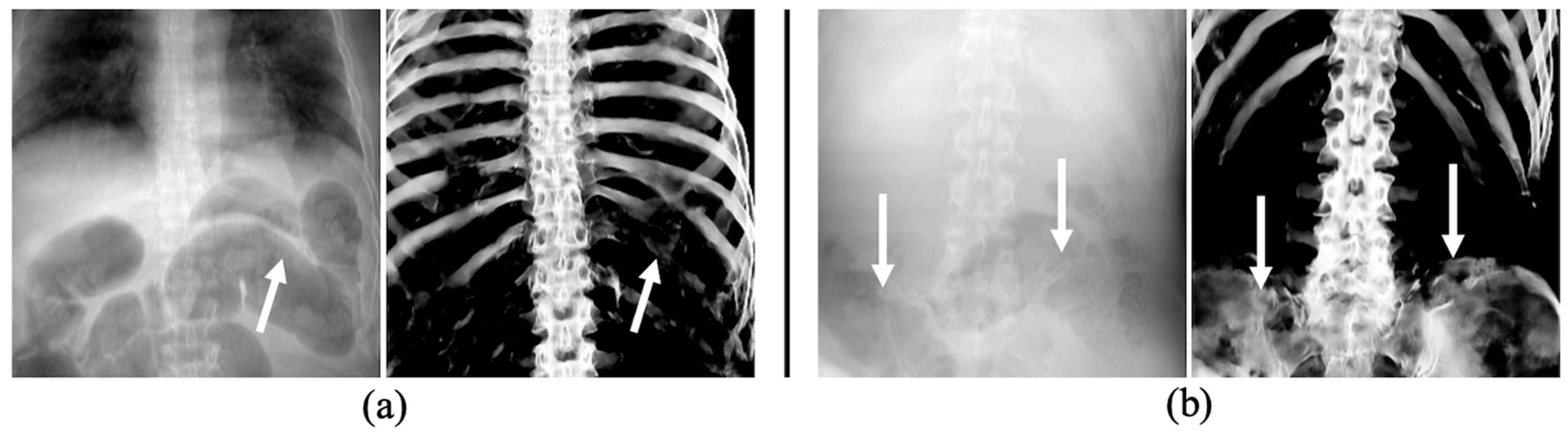Diagnostics 14 01778 g009