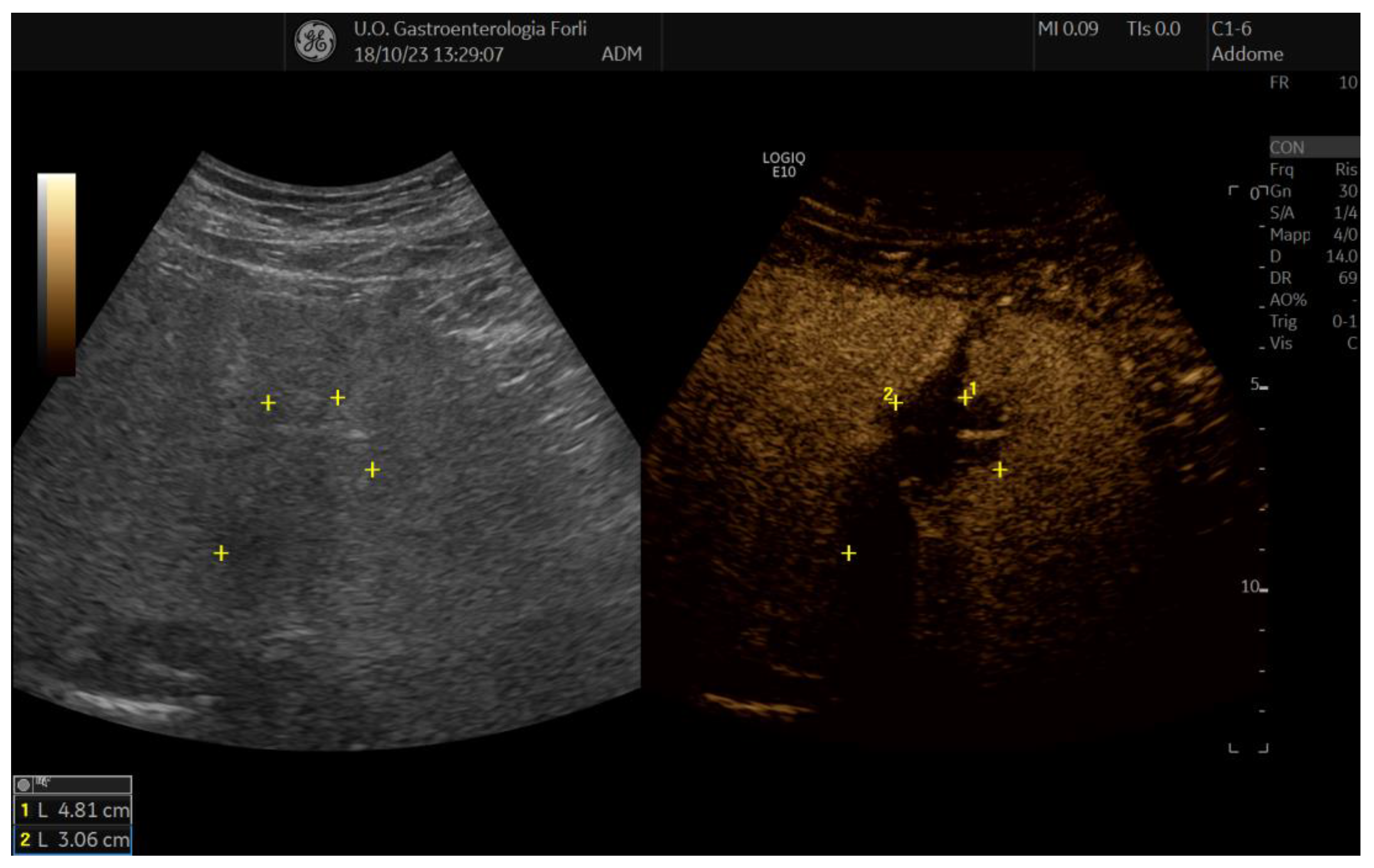 Diagnostics 14 01783 g002
