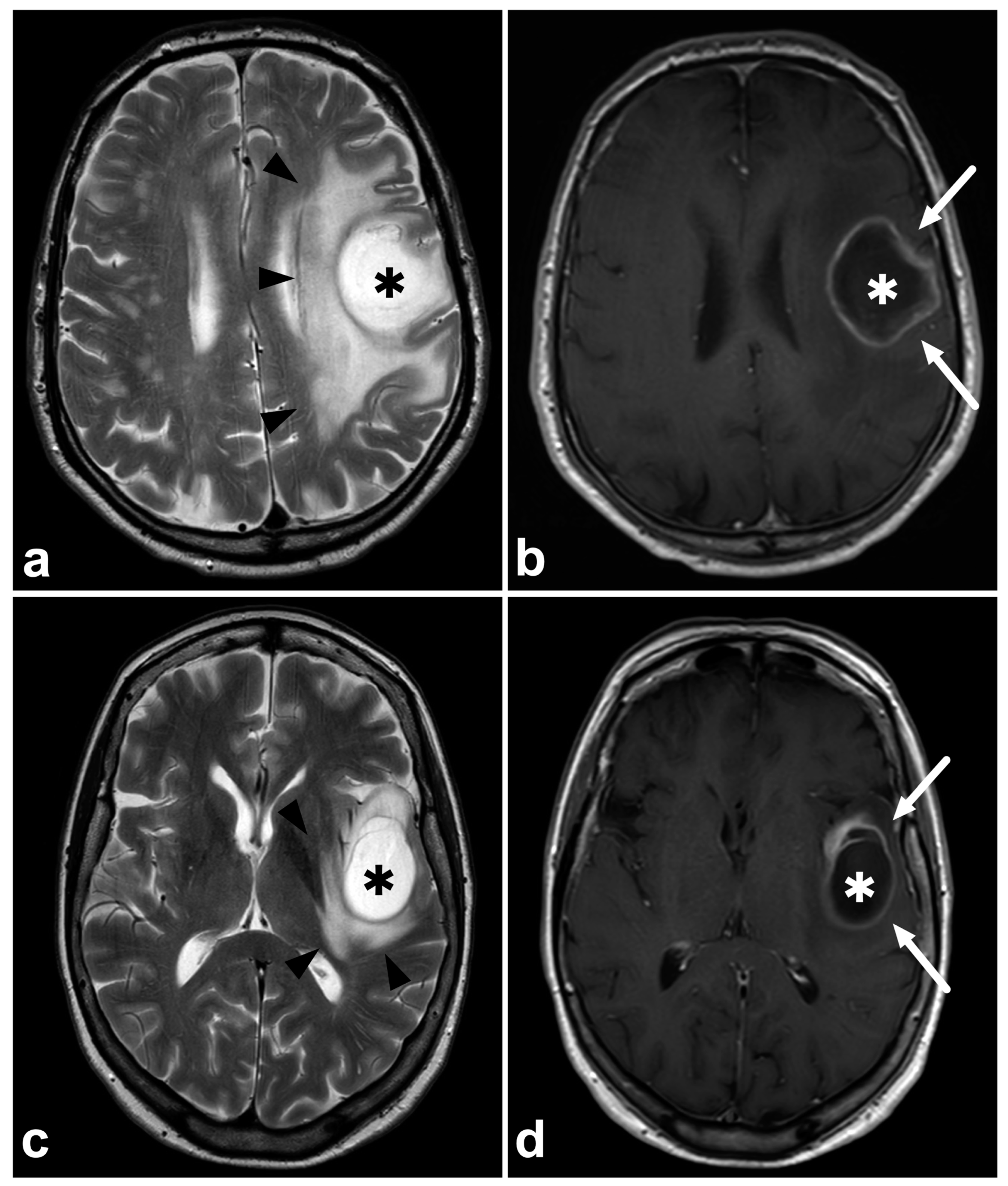 Diagnostics 14 01791 g002