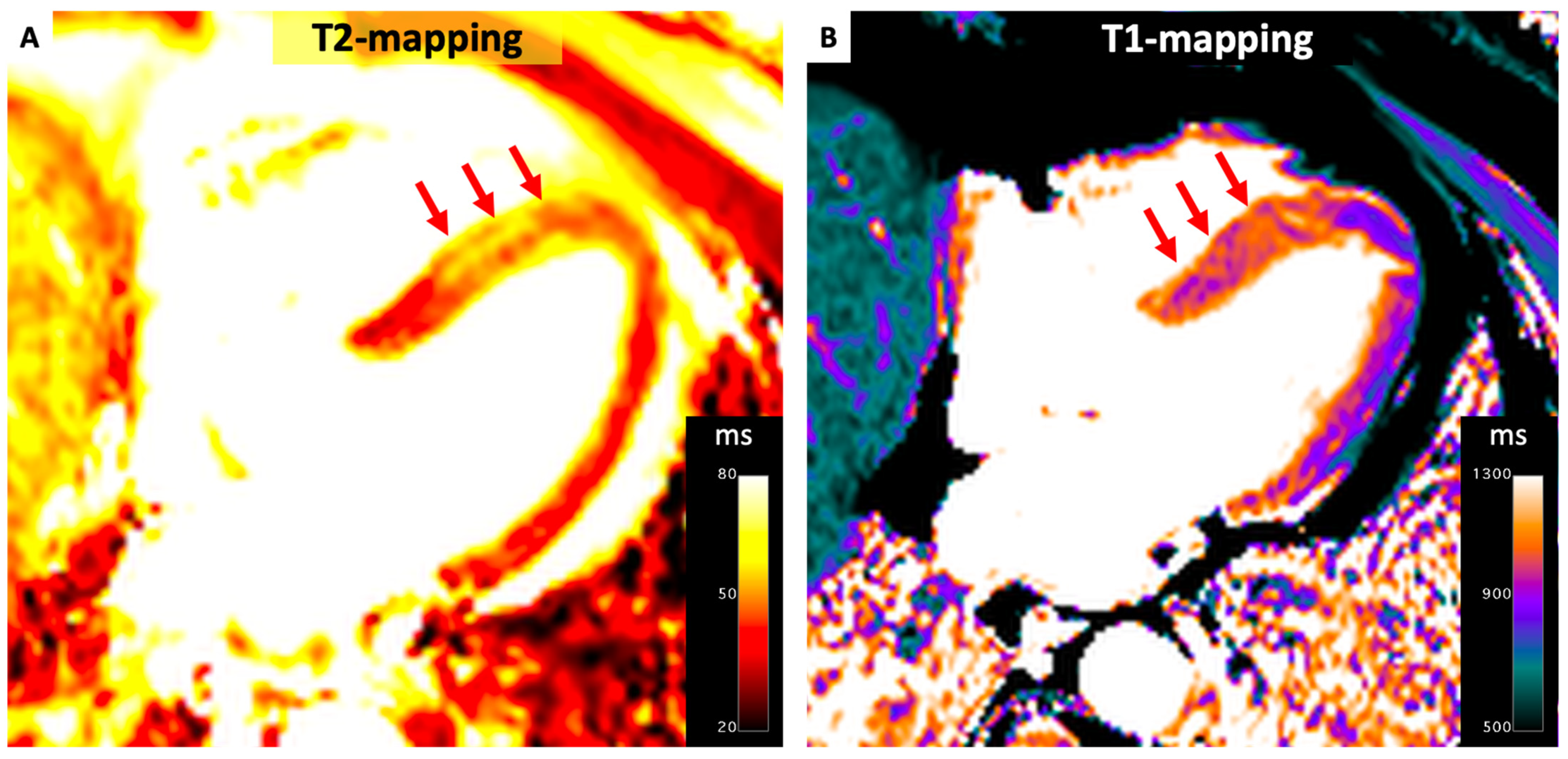 Diagnostics 14 01816 g003