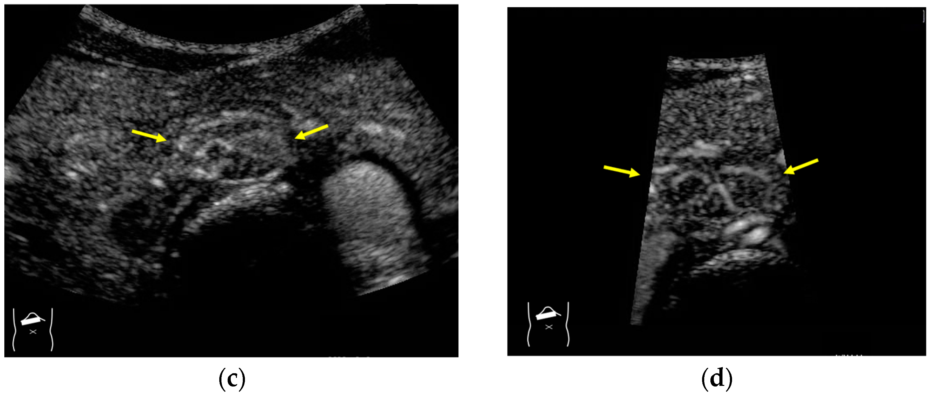 Diagnostics 14 01817 g001b