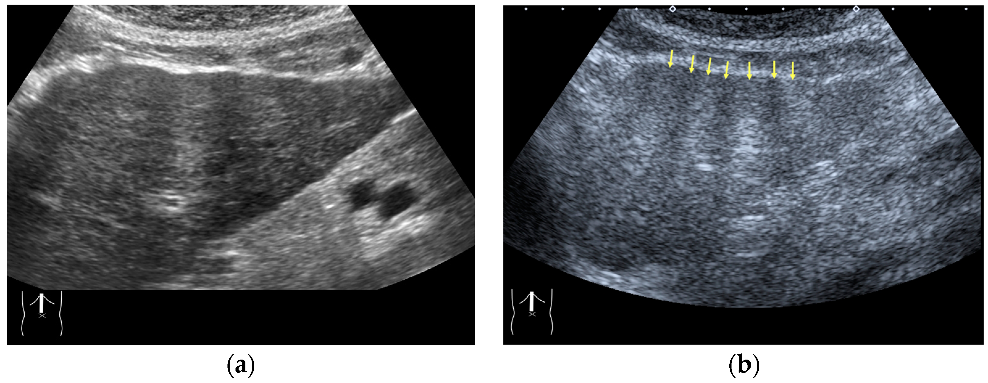 Diagnostics 14 01817 g003
