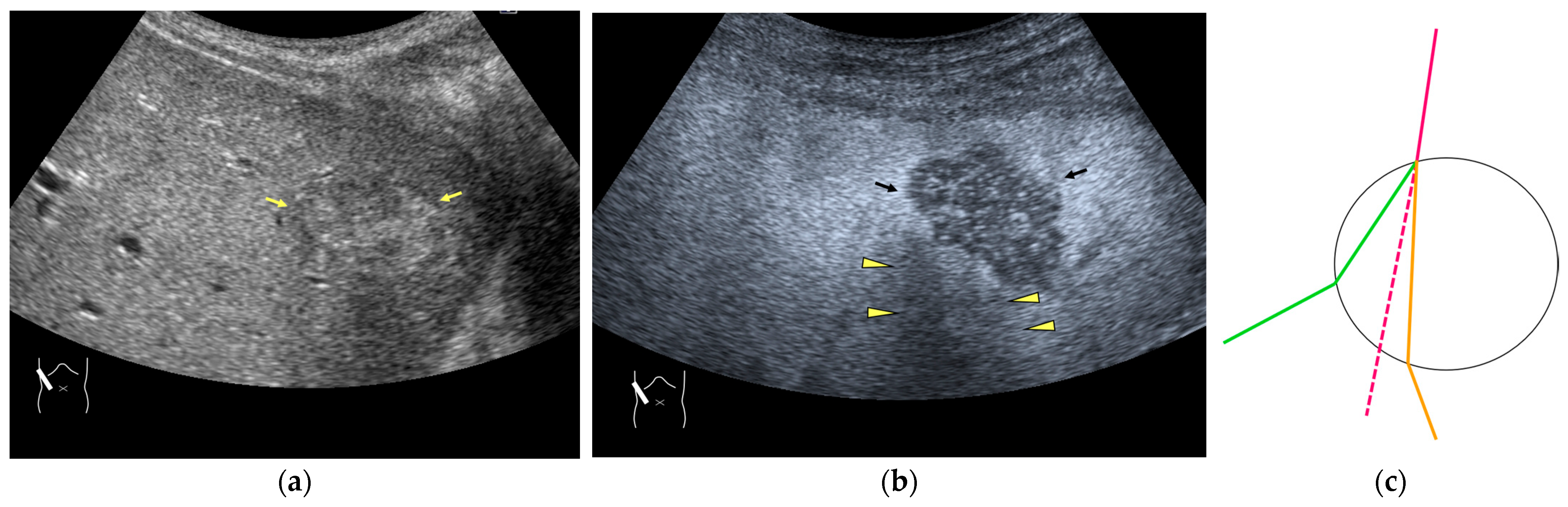 Diagnostics 14 01817 g004