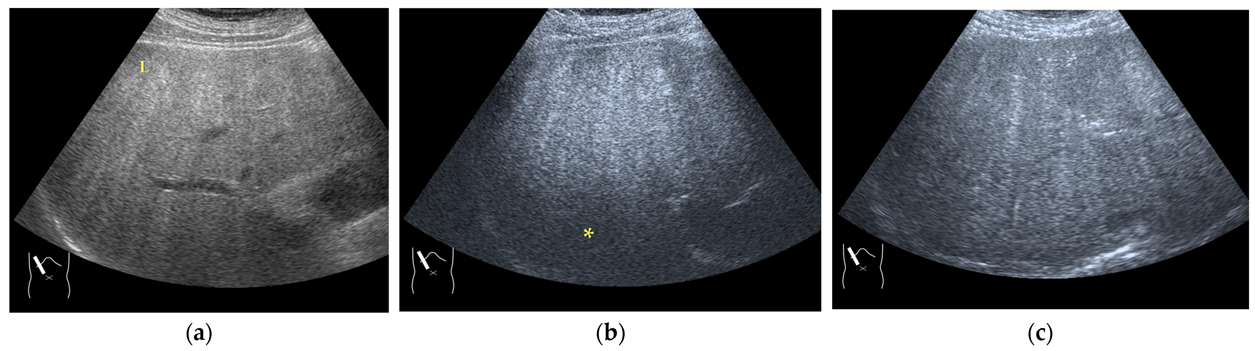 Diagnostics 14 01817 g007