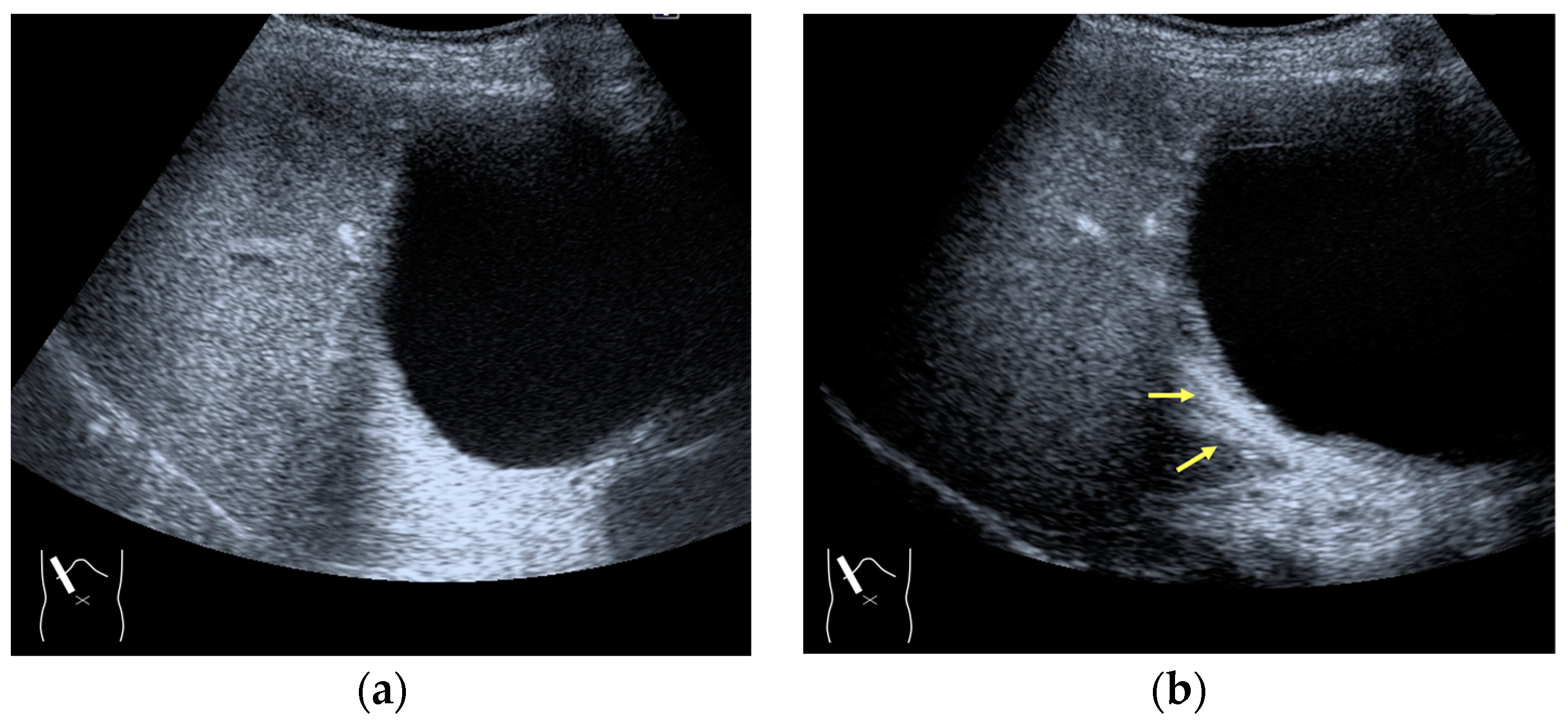 Diagnostics 14 01817 g008
