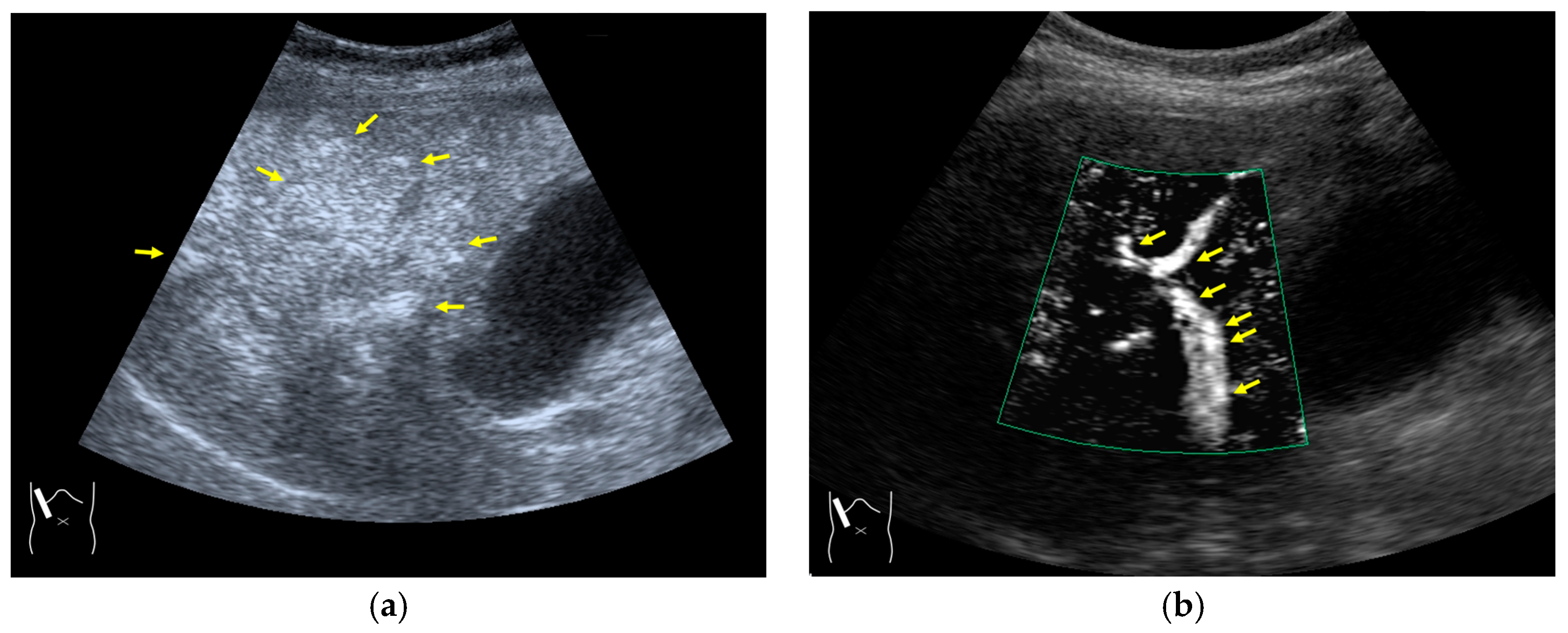 Diagnostics 14 01817 g013