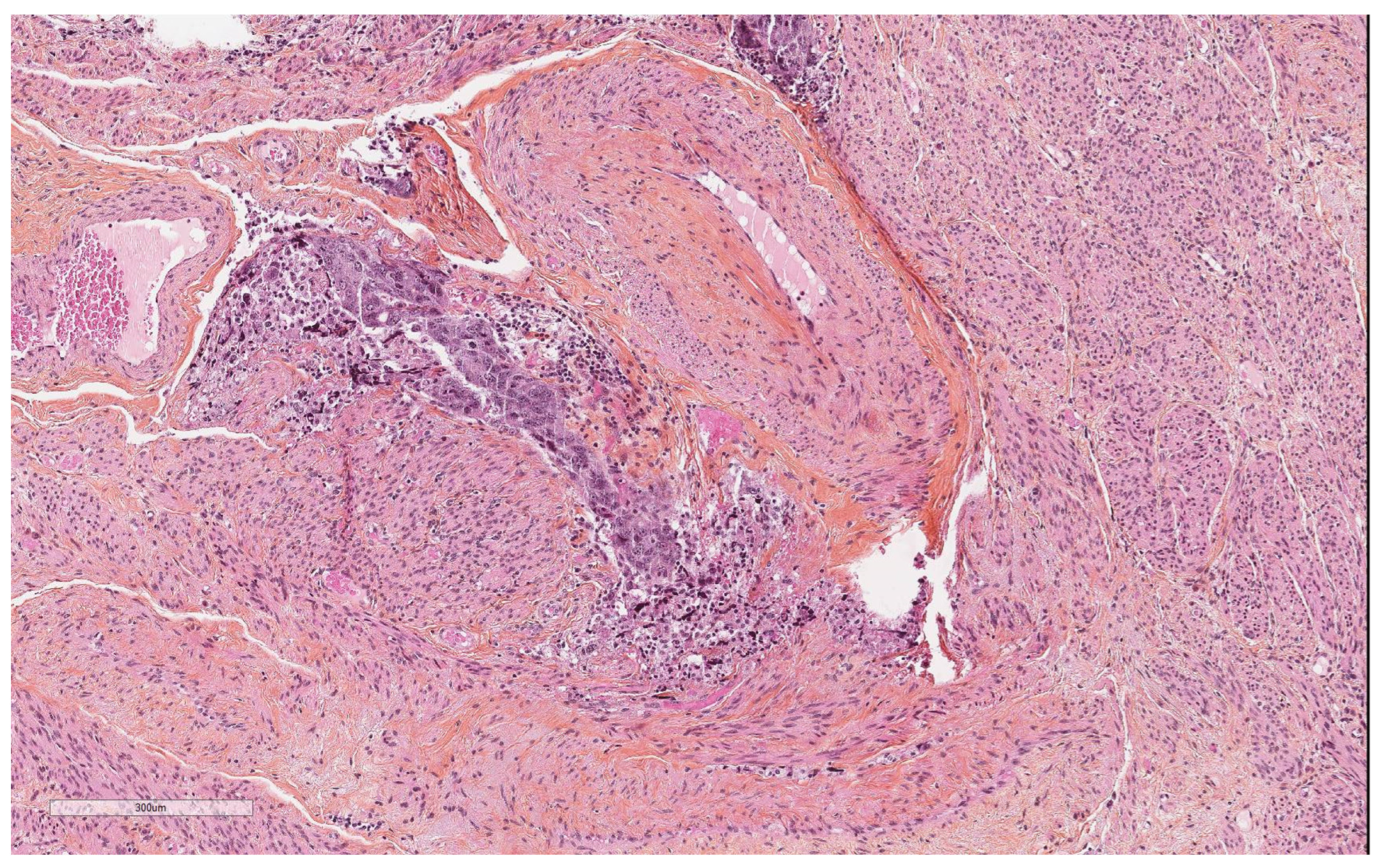 Diagnostics 14 01833 g004