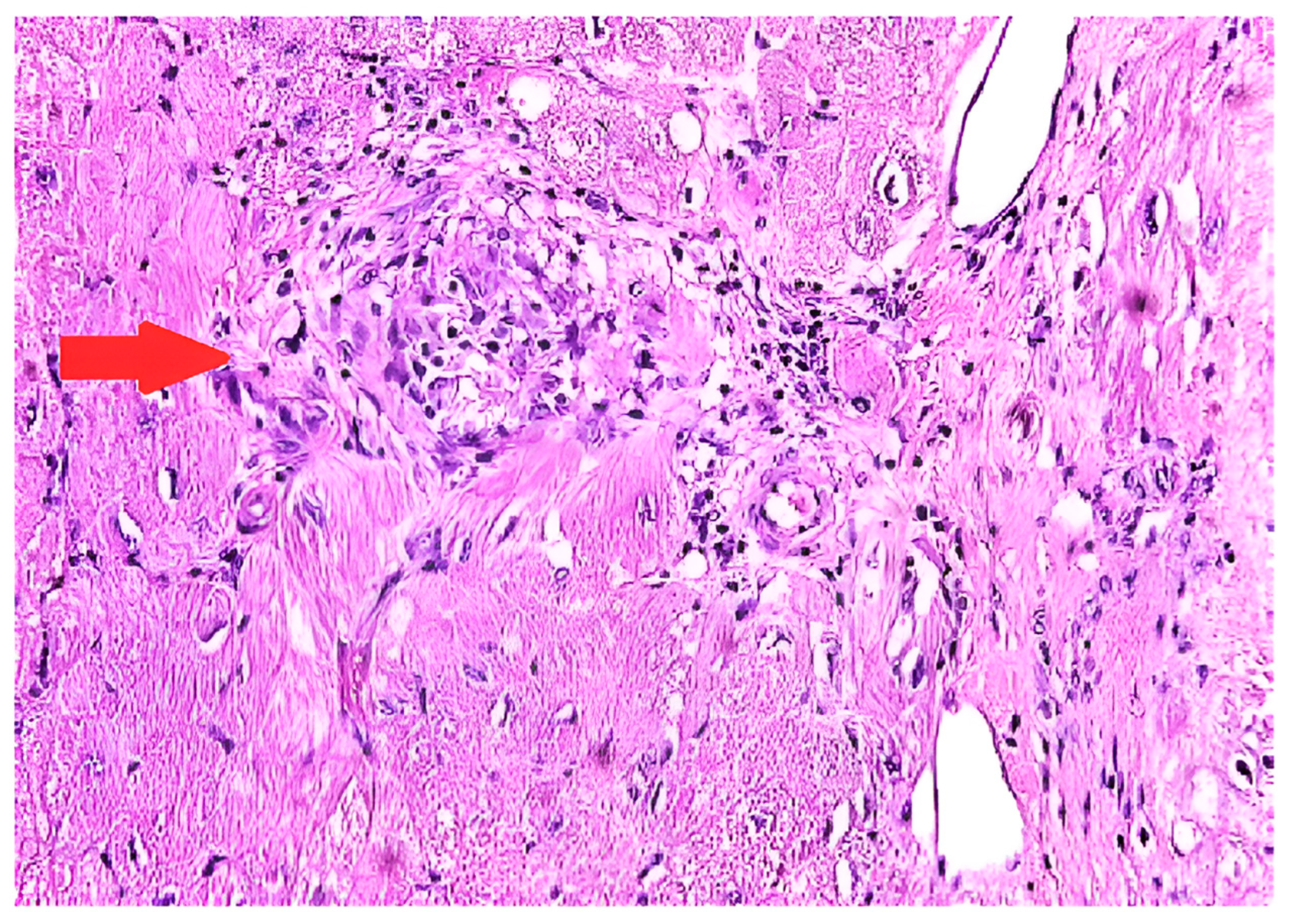 Diagnostics 14 01865 g002 Diagnostics 14 01865 g002