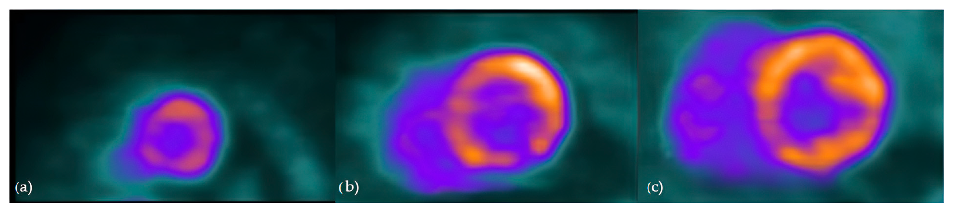 Diagnostics 14 01865 g005 Diagnostics 14 01865 g005