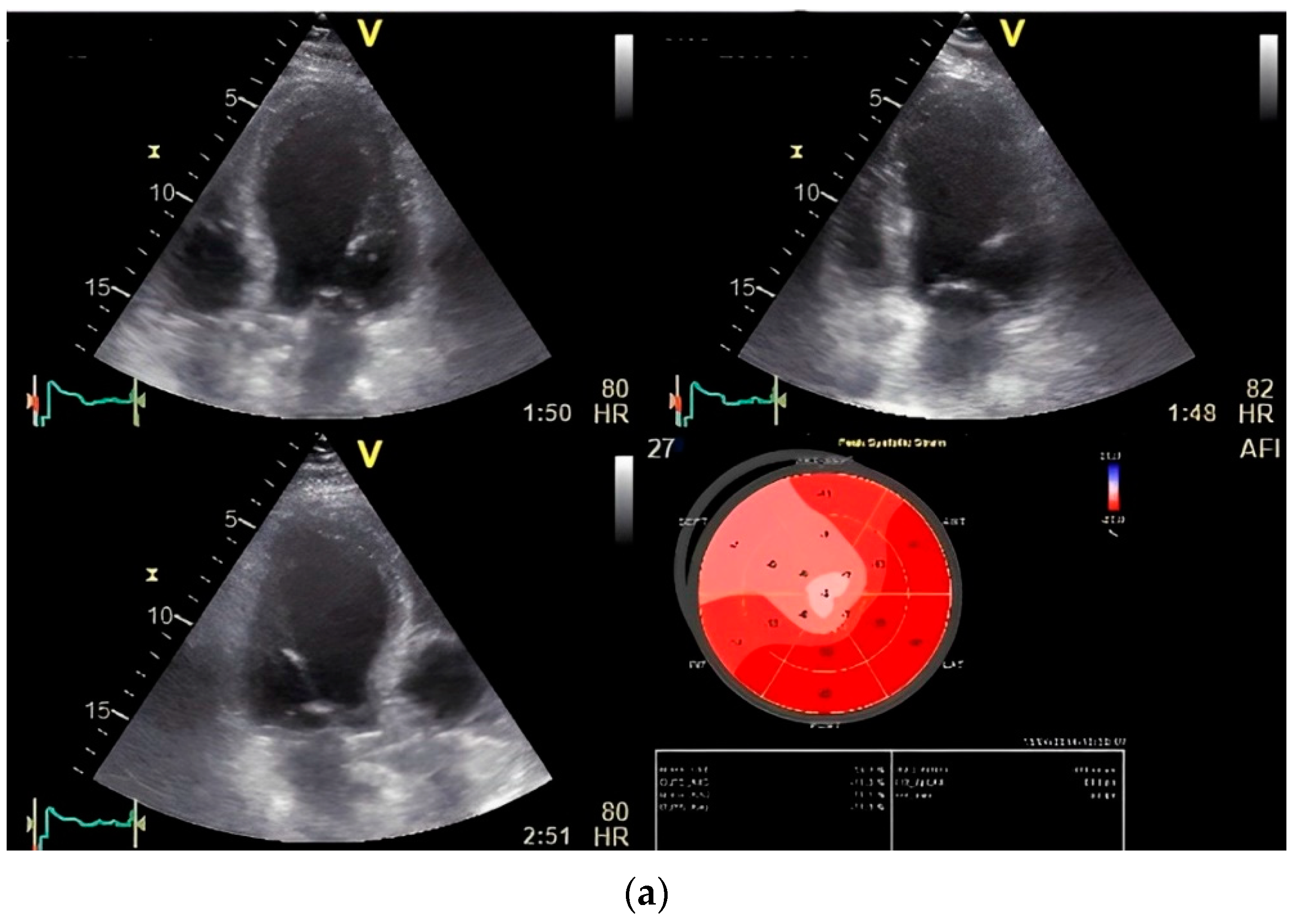 Diagnostics 14 01893 g005a