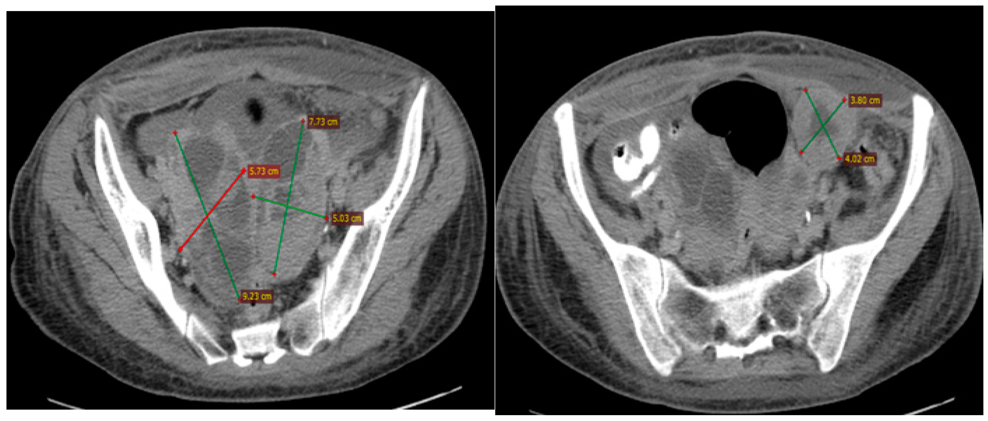 Diagnostics 14 01898 g001