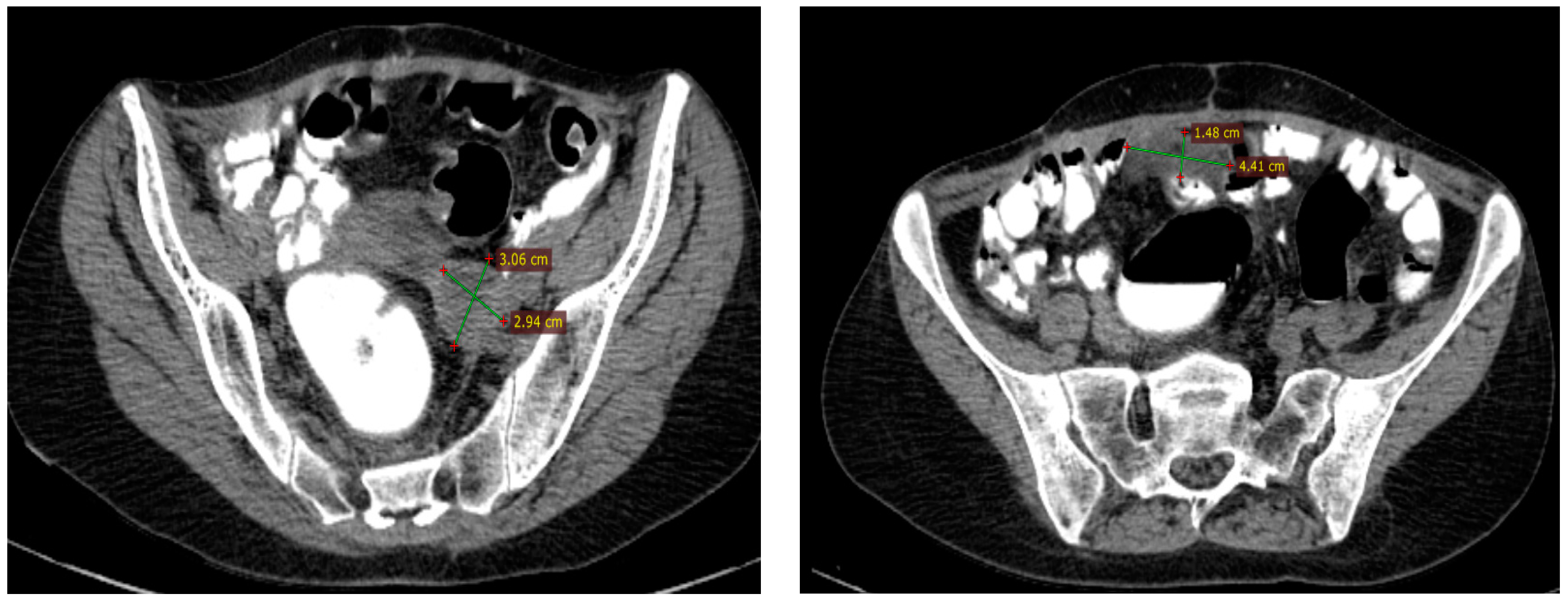 Diagnostics 14 01898 g003