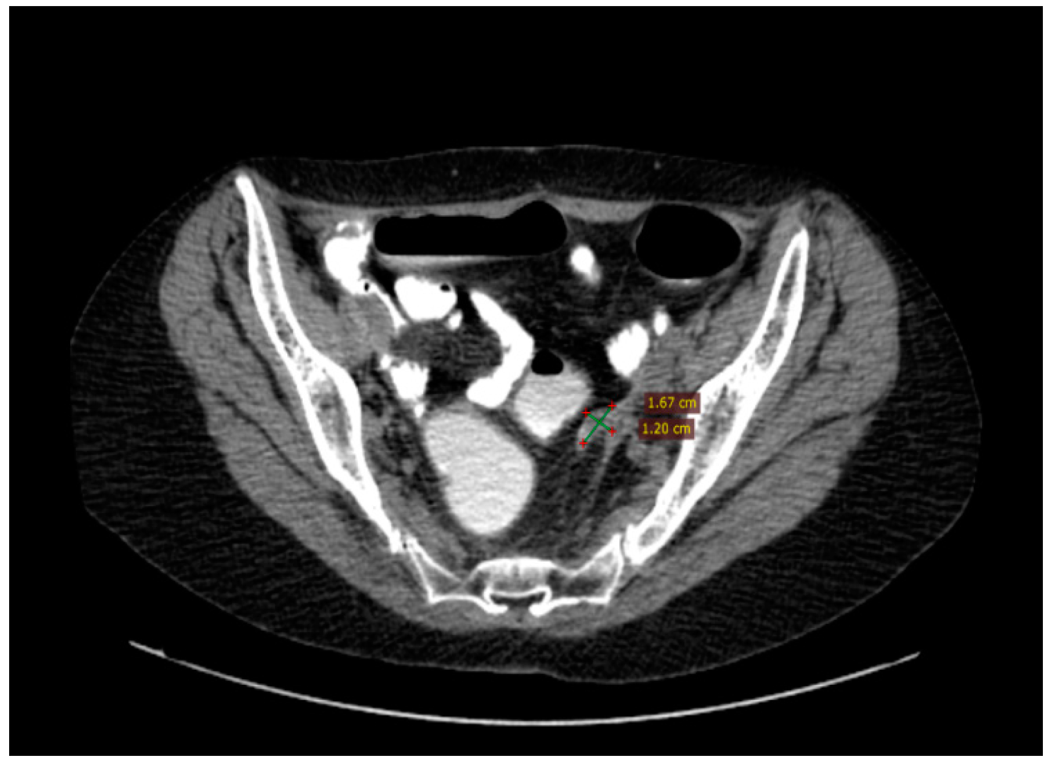 Diagnostics 14 01898 g004