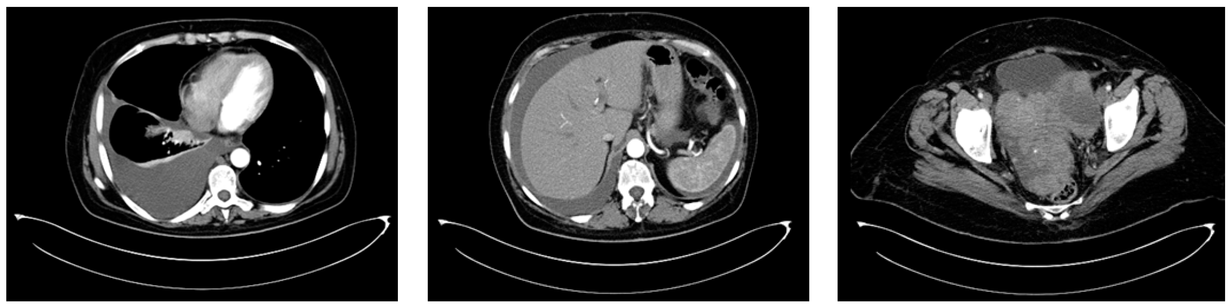 Diagnostics 14 01898 g007