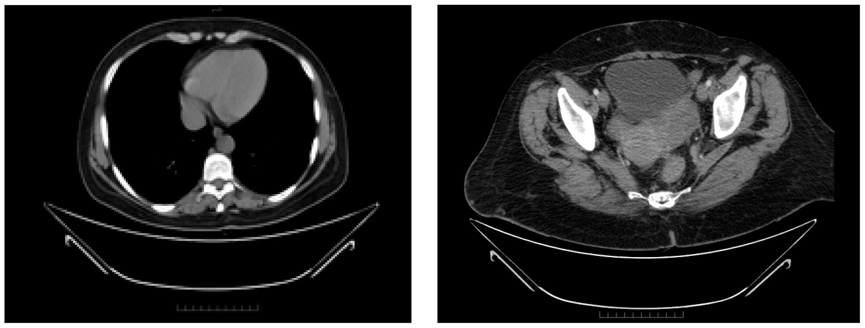 Diagnostics 14 01898 g008