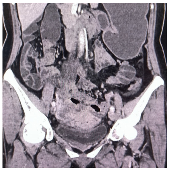 Diagnostics 14 01923 g001