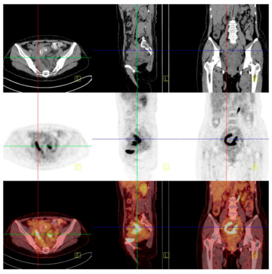 Diagnostics 14 01923 g002