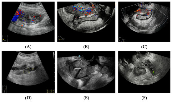 Diagnostics 14 01923 g003