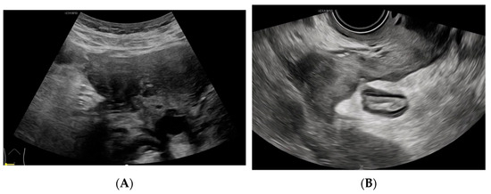 Diagnostics 14 01923 g004