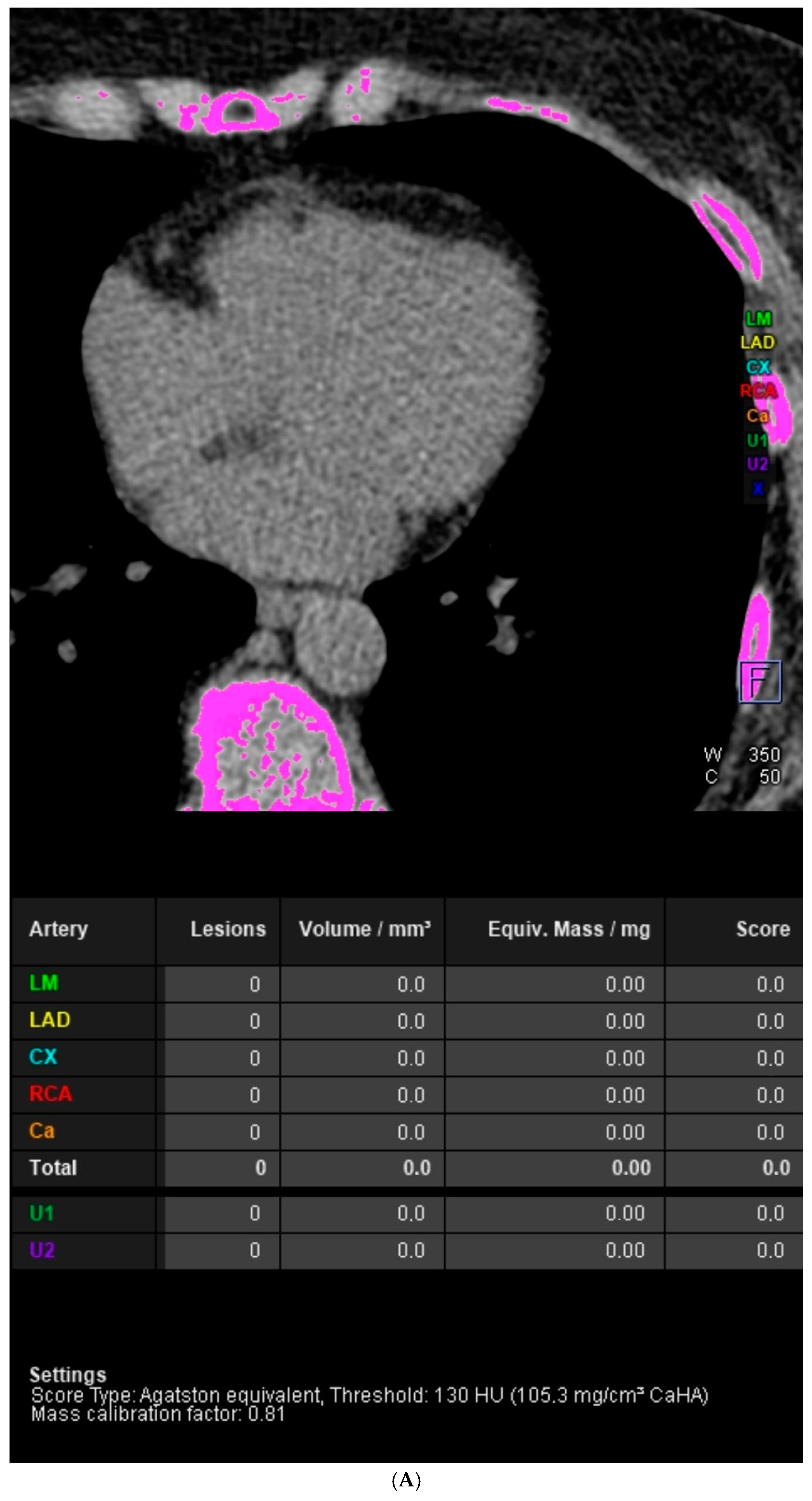 Diagnostics 14 01928 g001a