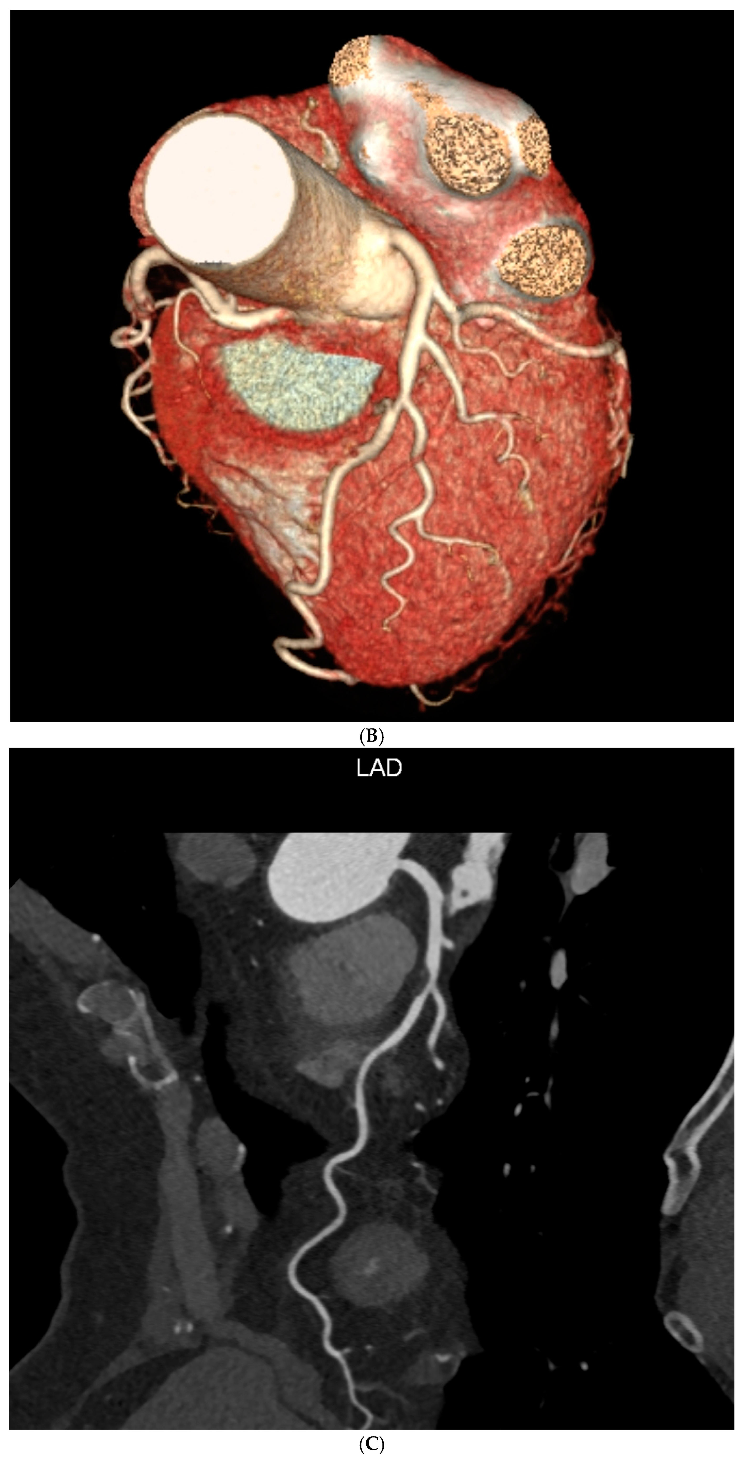Diagnostics 14 01928 g001b