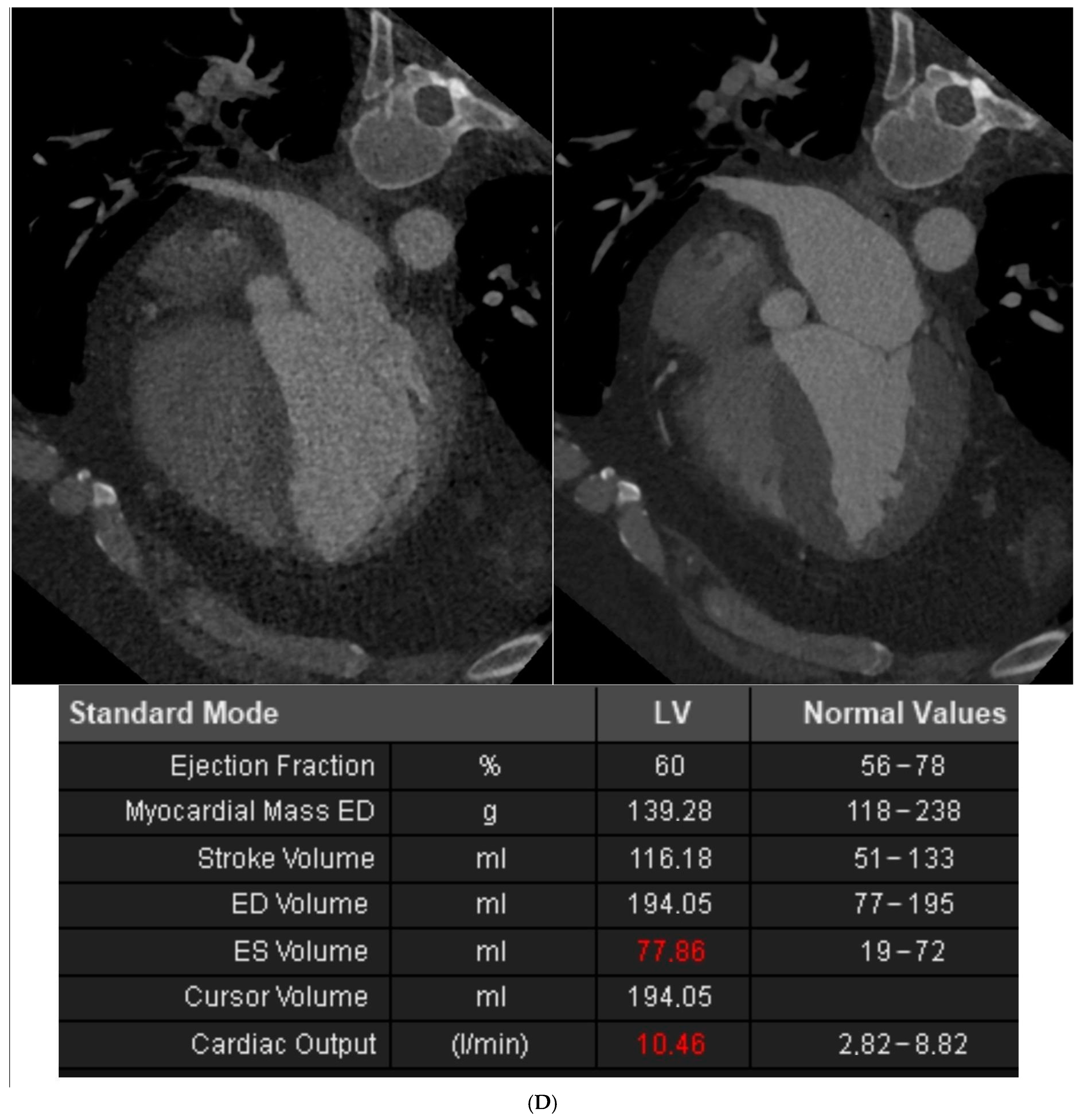 Diagnostics 14 01928 g002c