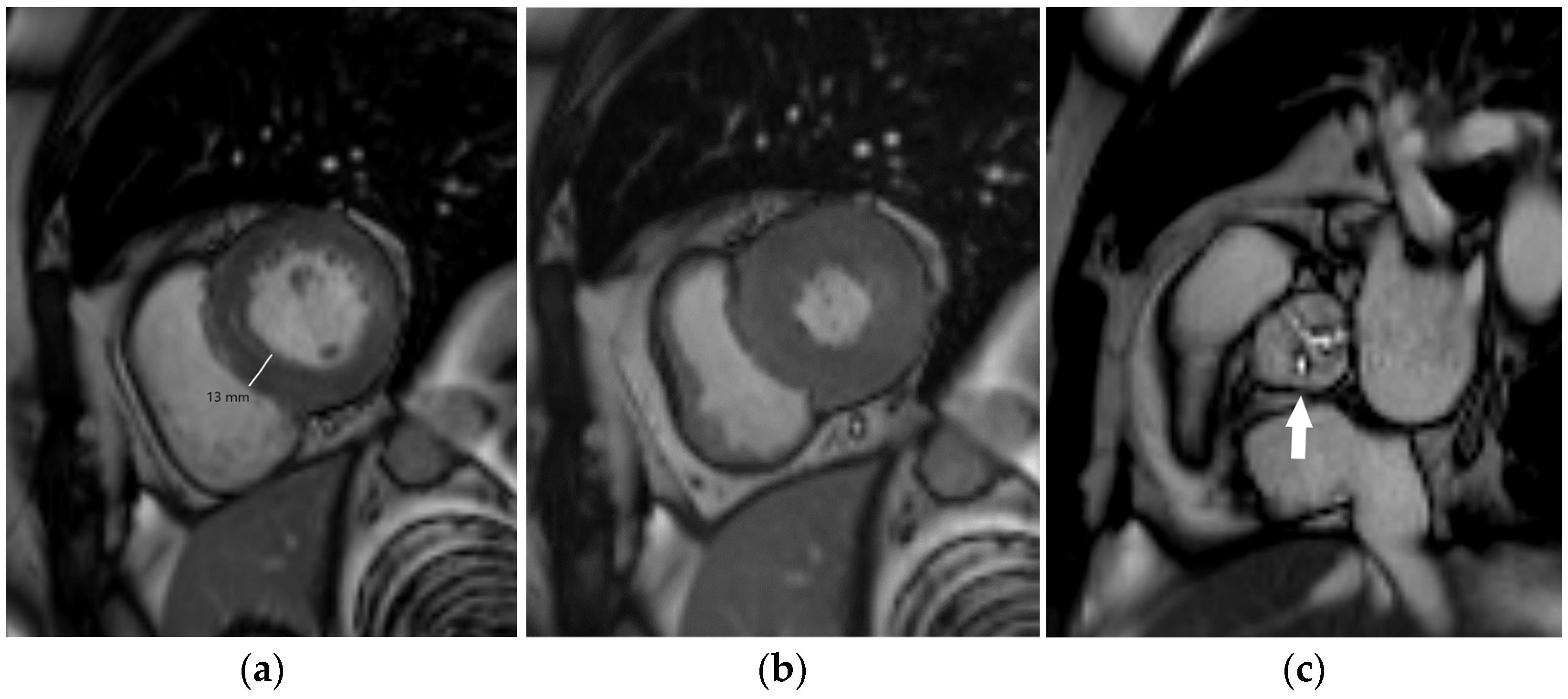 Diagnostics 14 01947 g002 Diagnostics 14 01947 g002