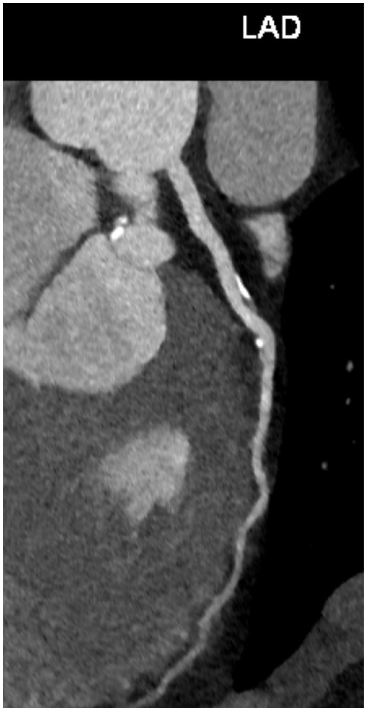 Diagnostics 14 01947 g005 Diagnostics 14 01947 g005