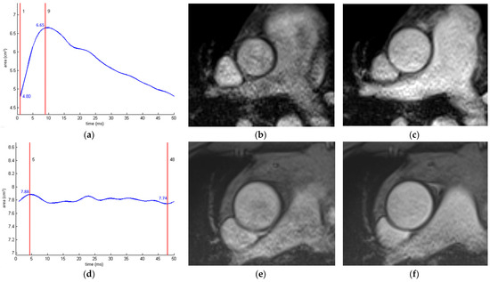 Diagnostics 14 01947 g009