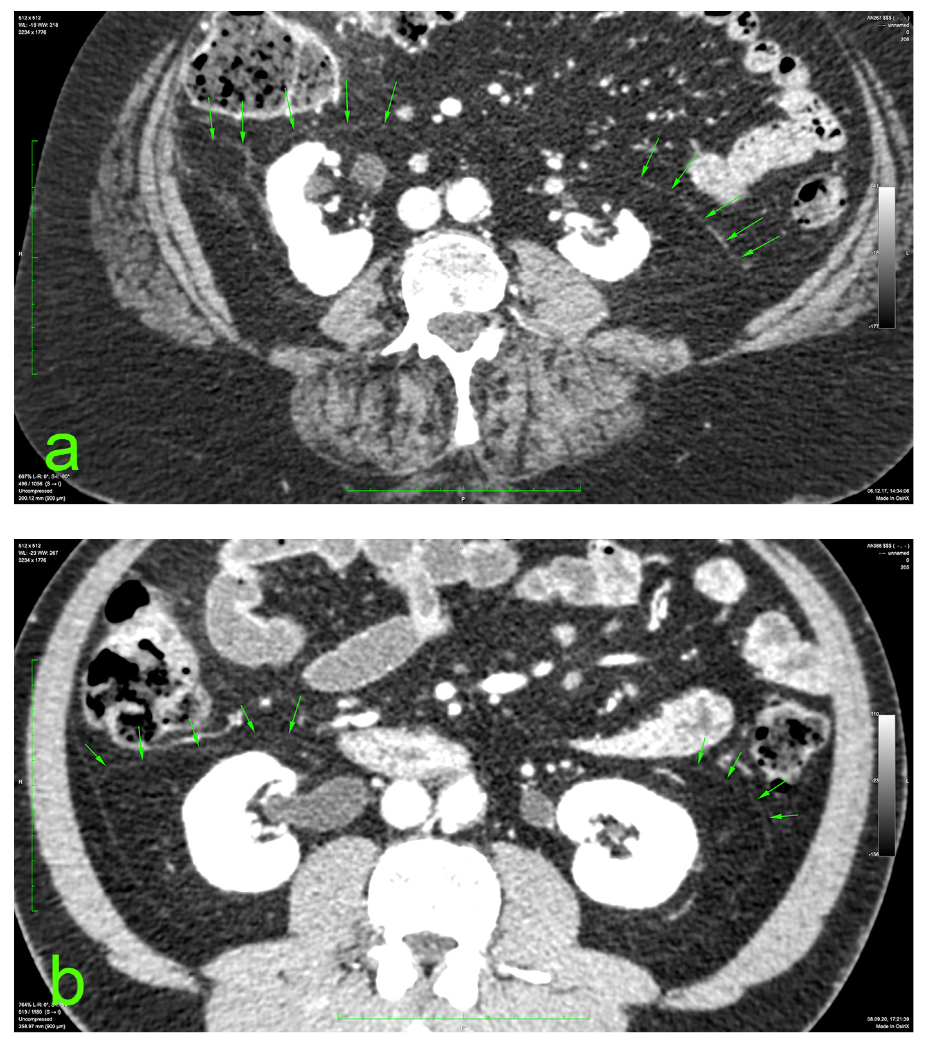 Diagnostics 14 01952 g001