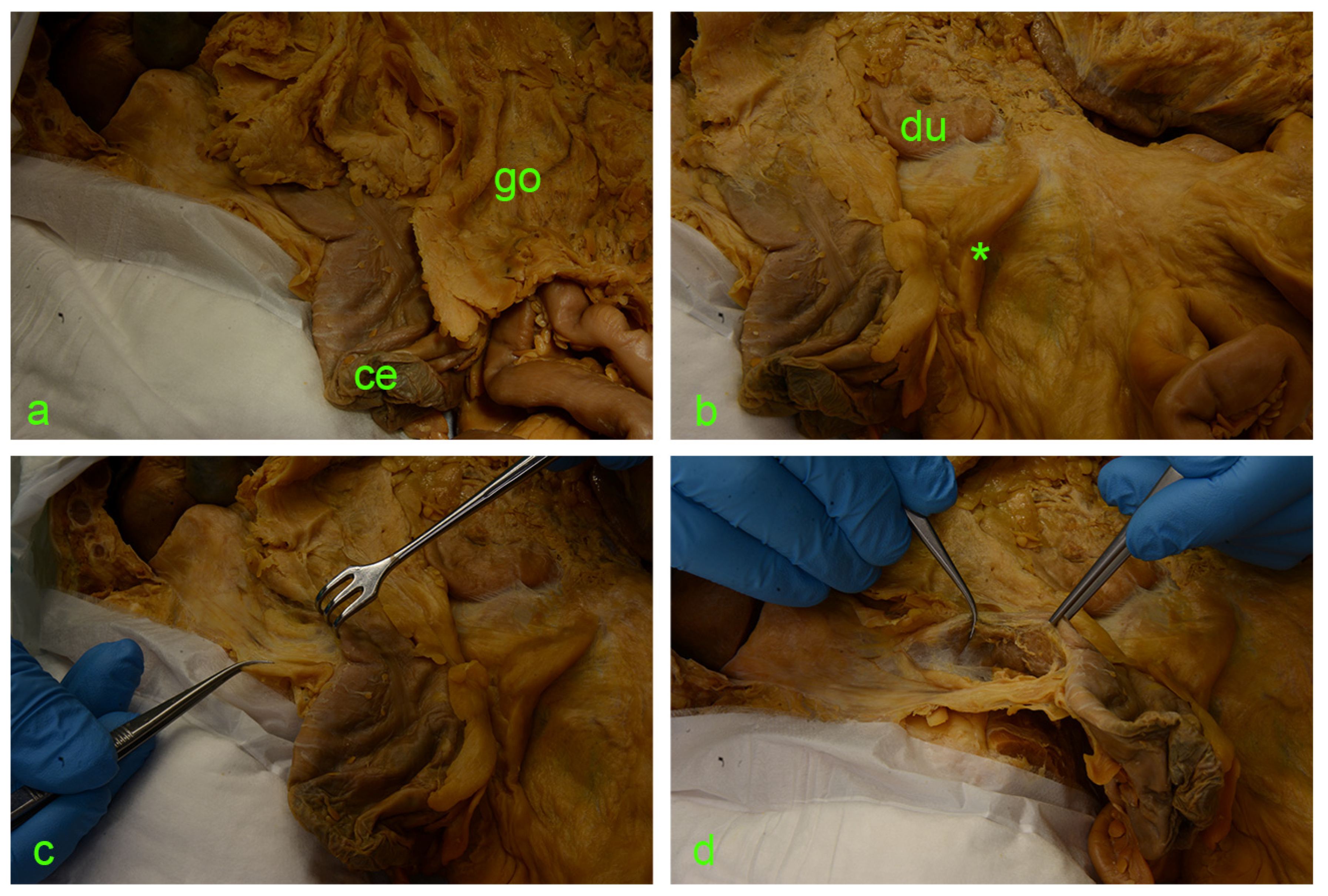 Diagnostics 14 01952 g002