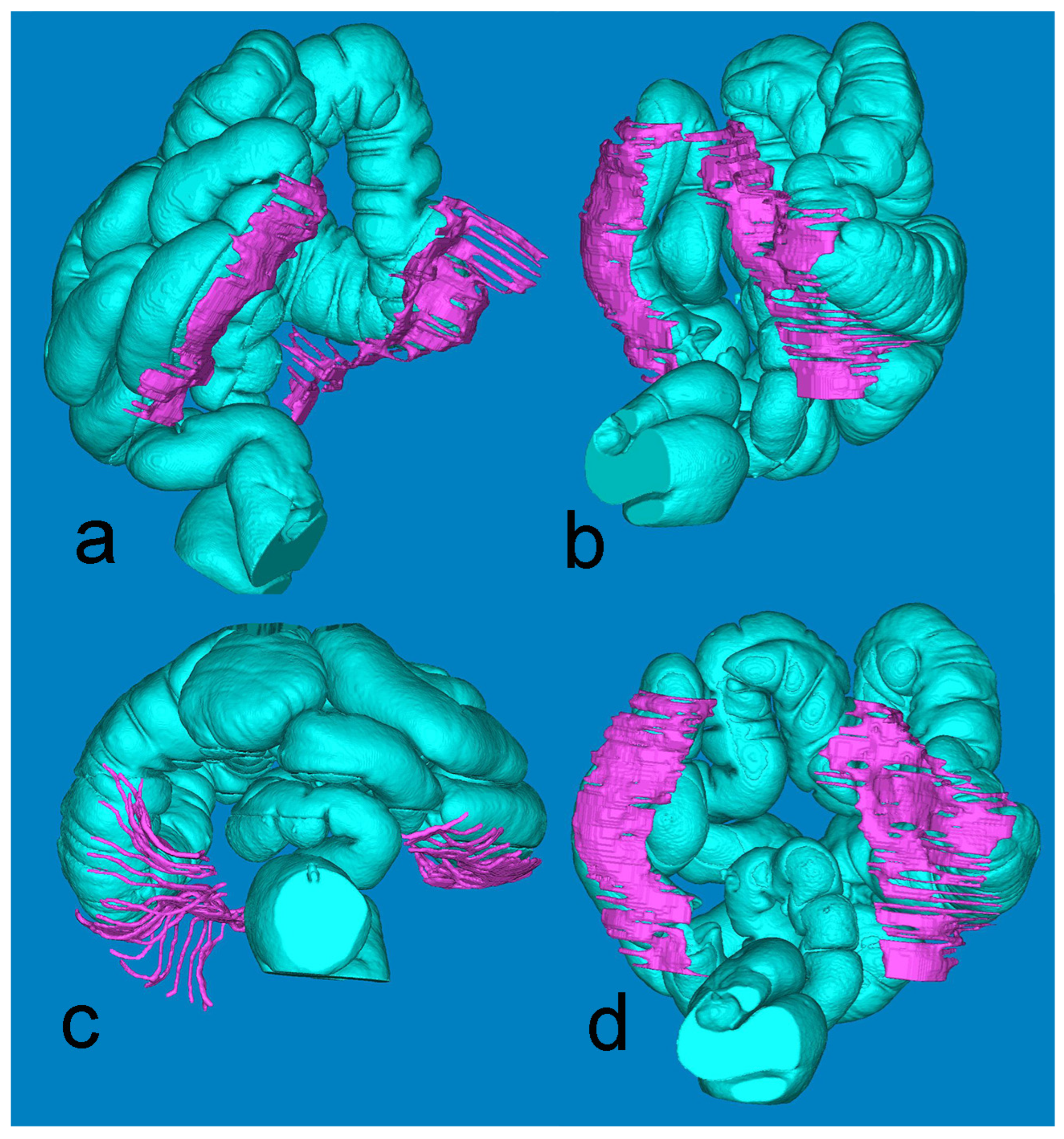 Diagnostics 14 01952 g004