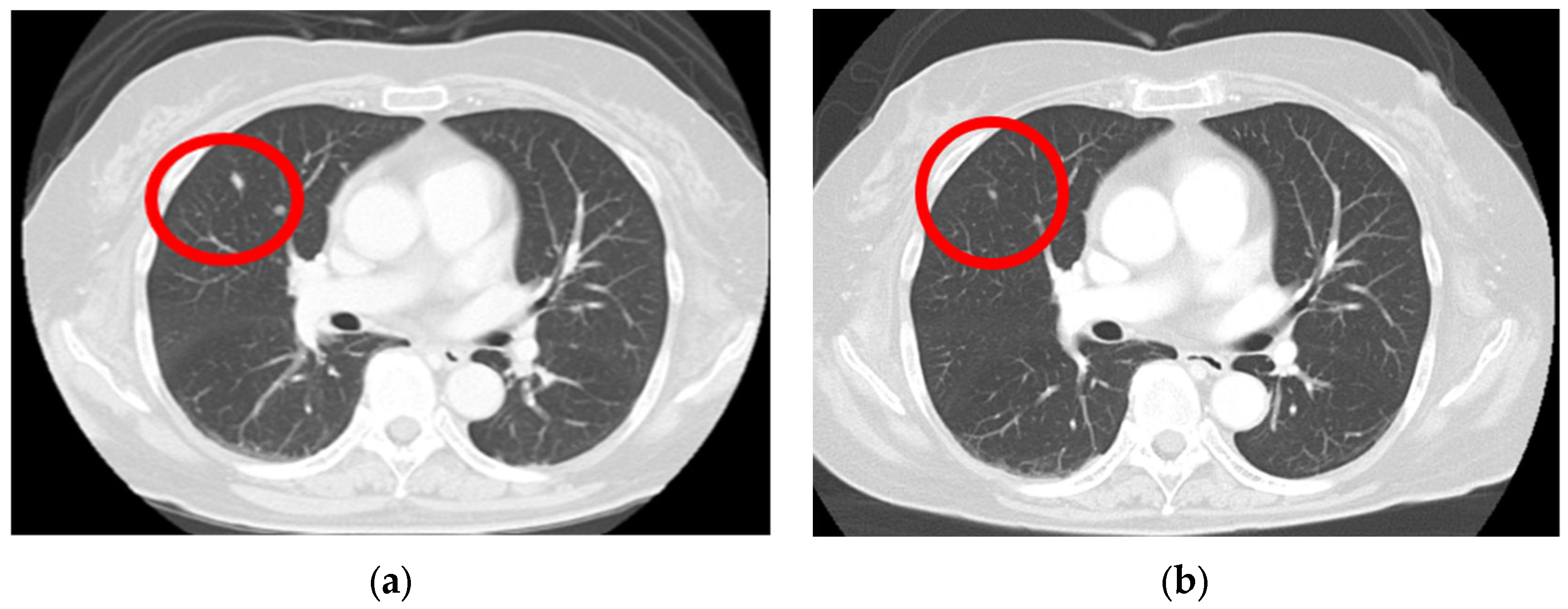 Diagnostics 14 01958 g003