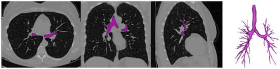 Diagnostics 14 01979 g003