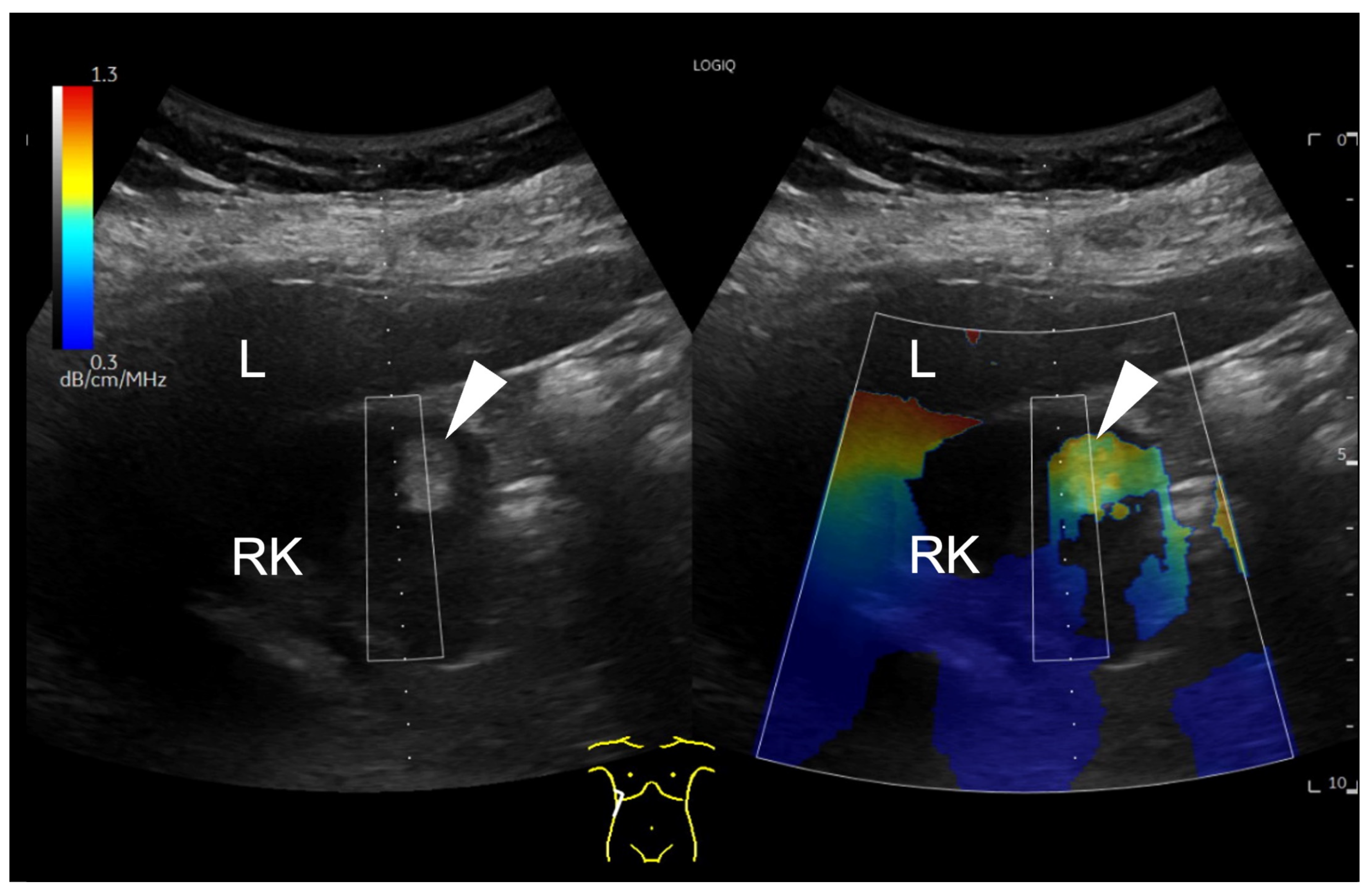 Diagnostics 14 02002 g001