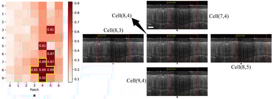 Diagnostics 14 02009 g0a2