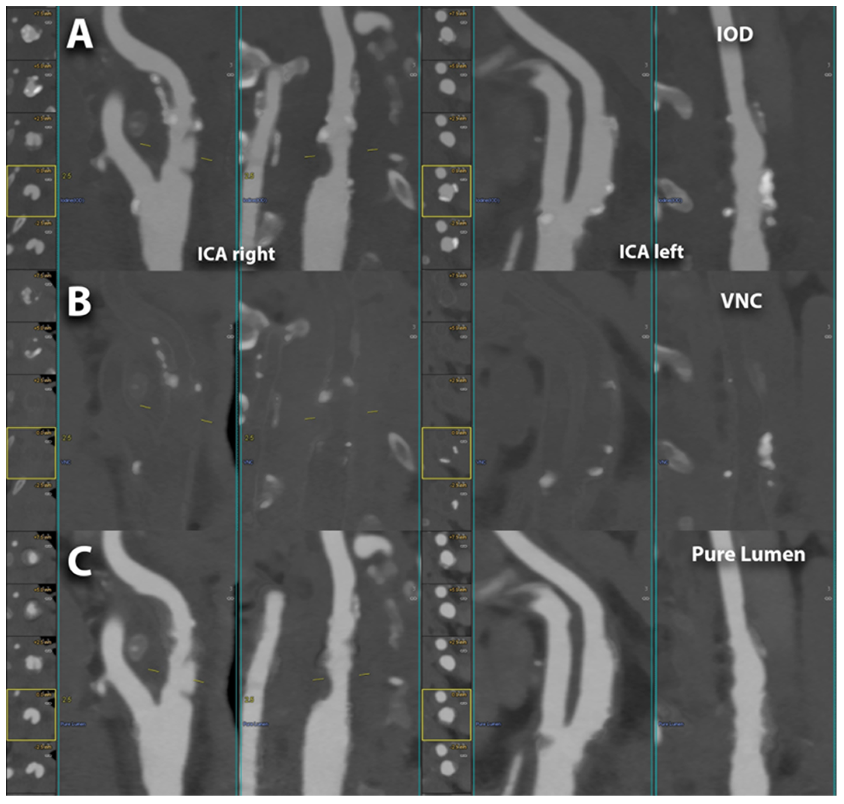 Diagnostics 14 02012 g005