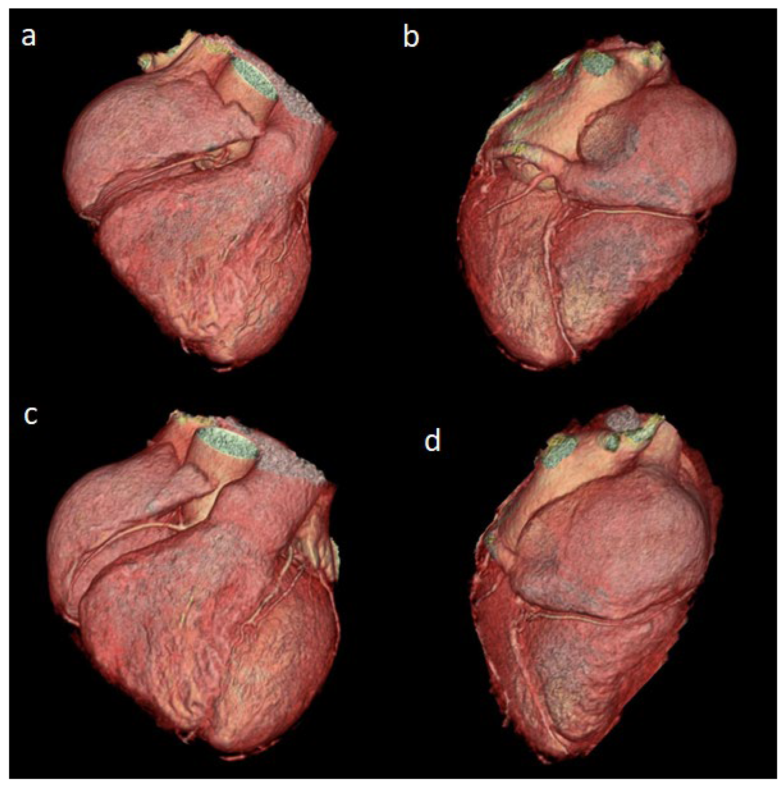 Diagnostics 14 02022 g001